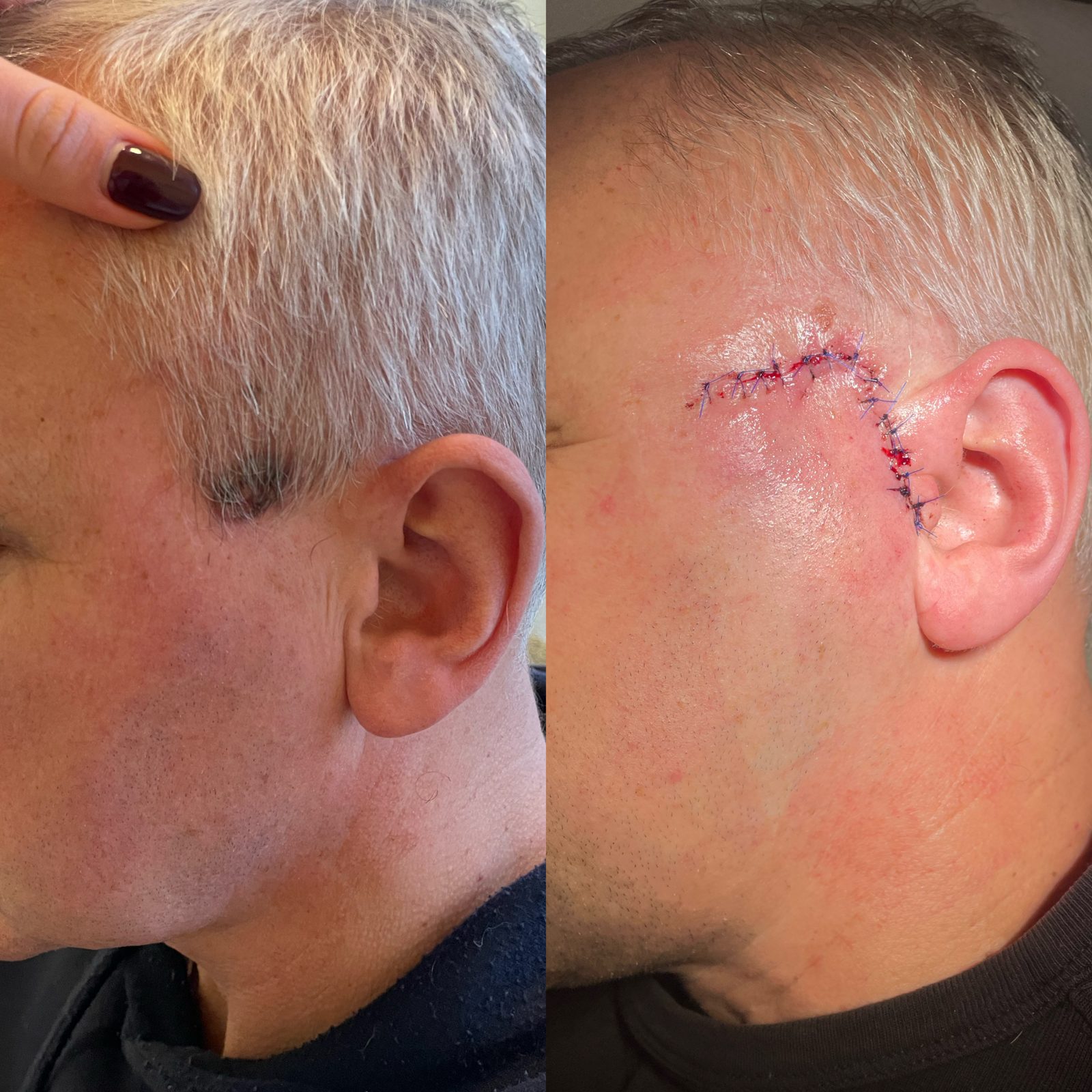 Pacientės nuotrauka „prieš ir po" – patient_055.jpg