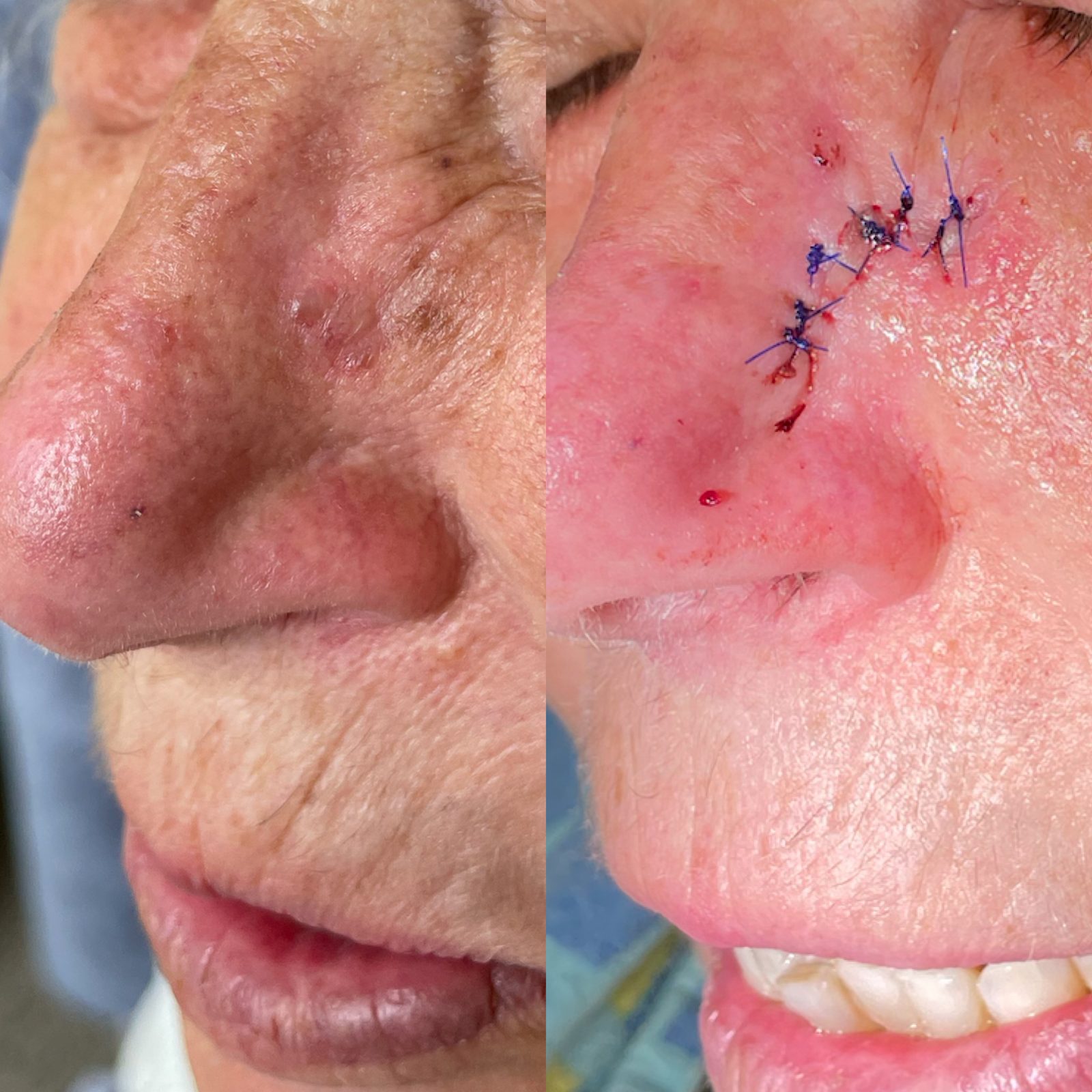 Pacientės nuotrauka „prieš ir po" – patient_025.jpg