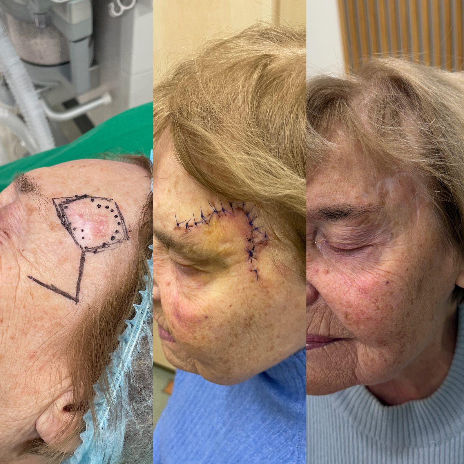 Pacientės nuotrauka „prieš ir po" – patient_060.jpg