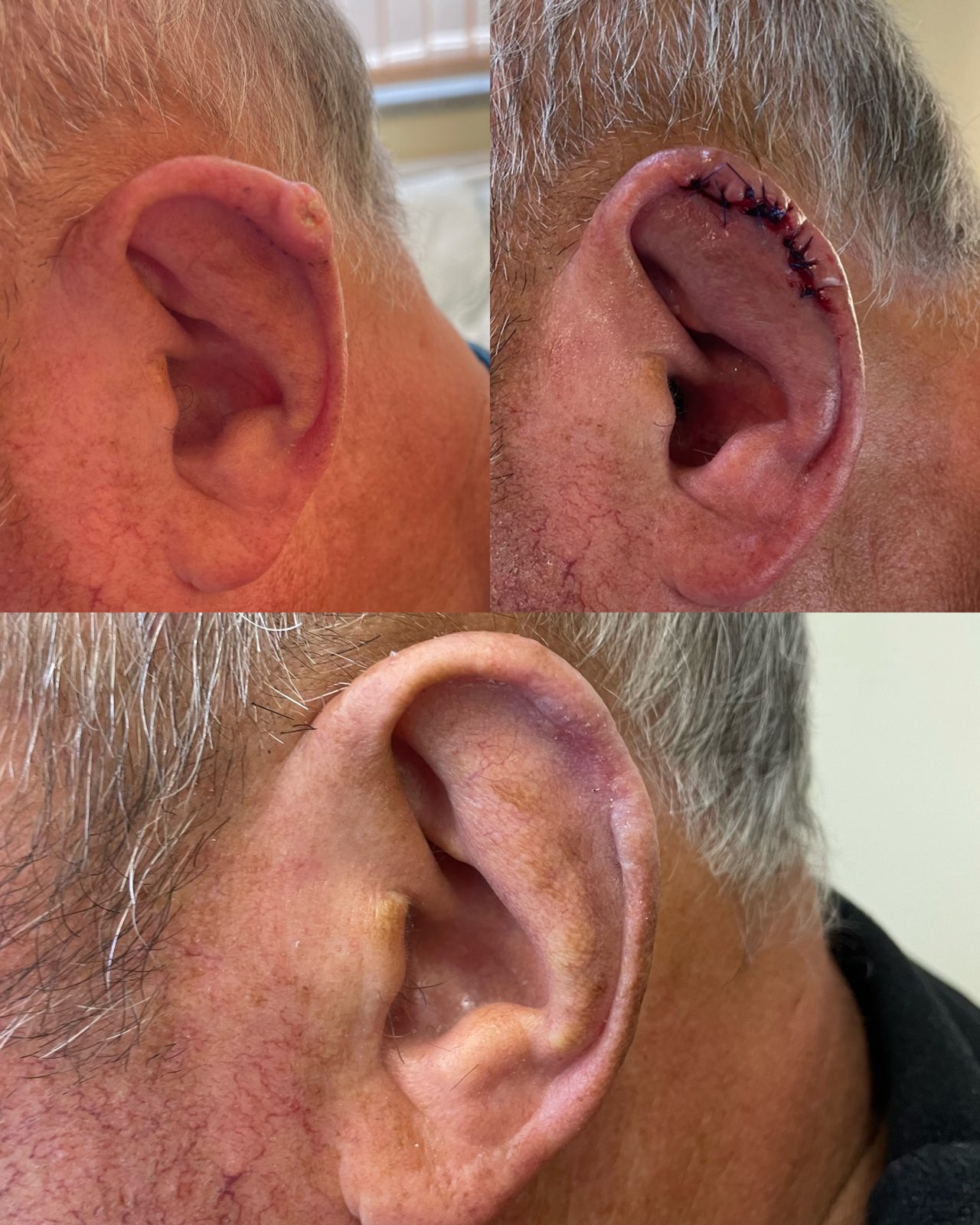Pacientės nuotrauka „prieš ir po" – patient_041.jpg
