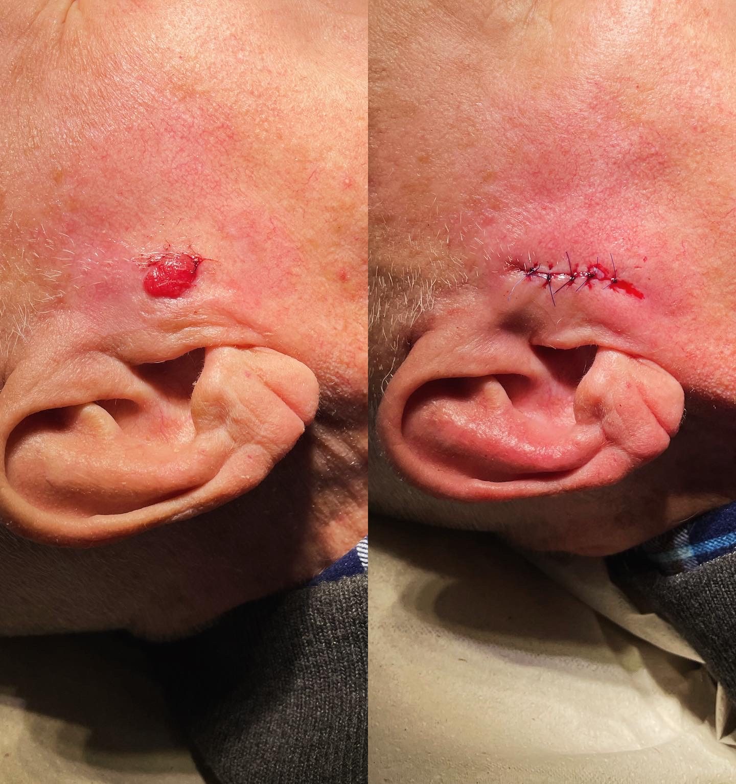 Pacientės nuotrauka „prieš ir po" – patient_003.jpg