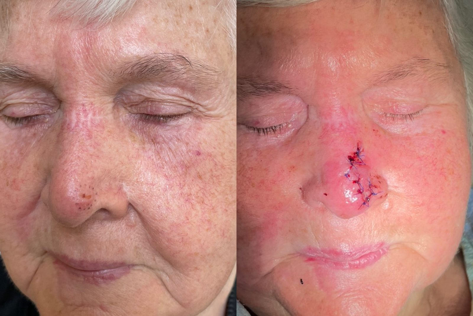 Pacientės nuotrauka „prieš ir po" – patient_039.jpg