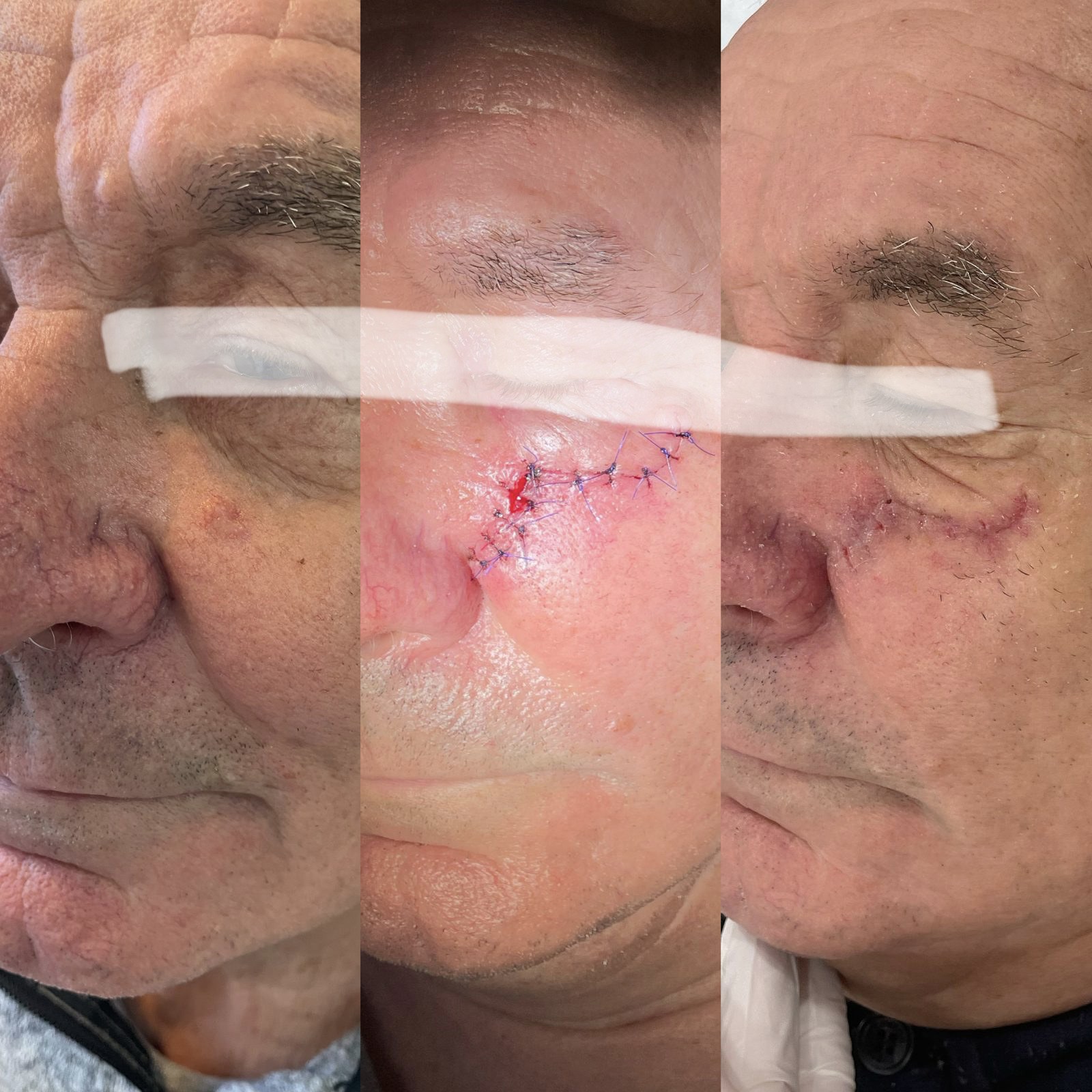 Pacientės nuotrauka „prieš ir po" – patient_new_01.jpg
