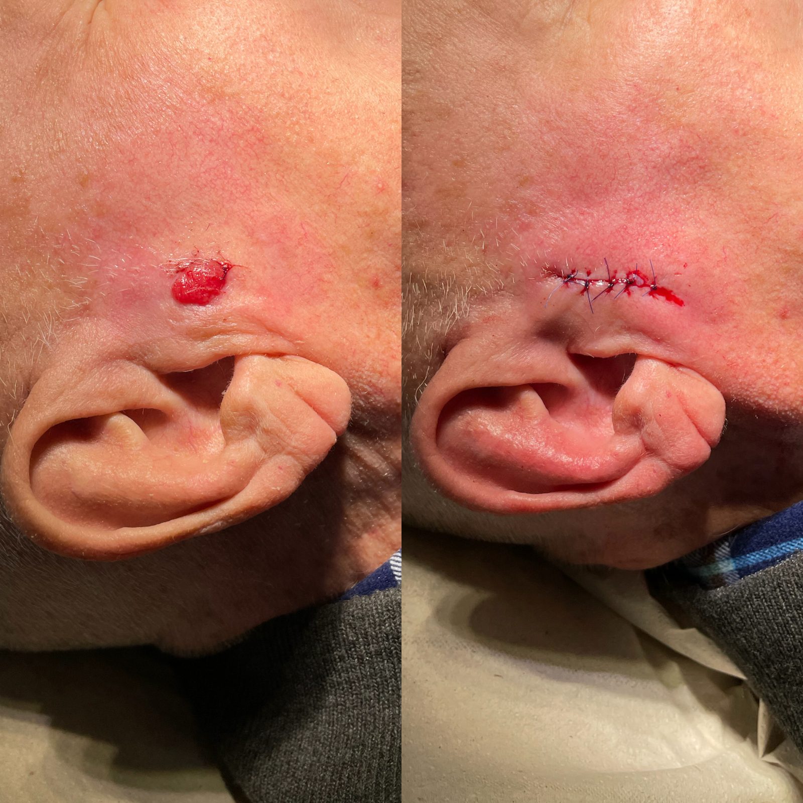 Pacientės nuotrauka „prieš ir po" – patient_026.jpg
