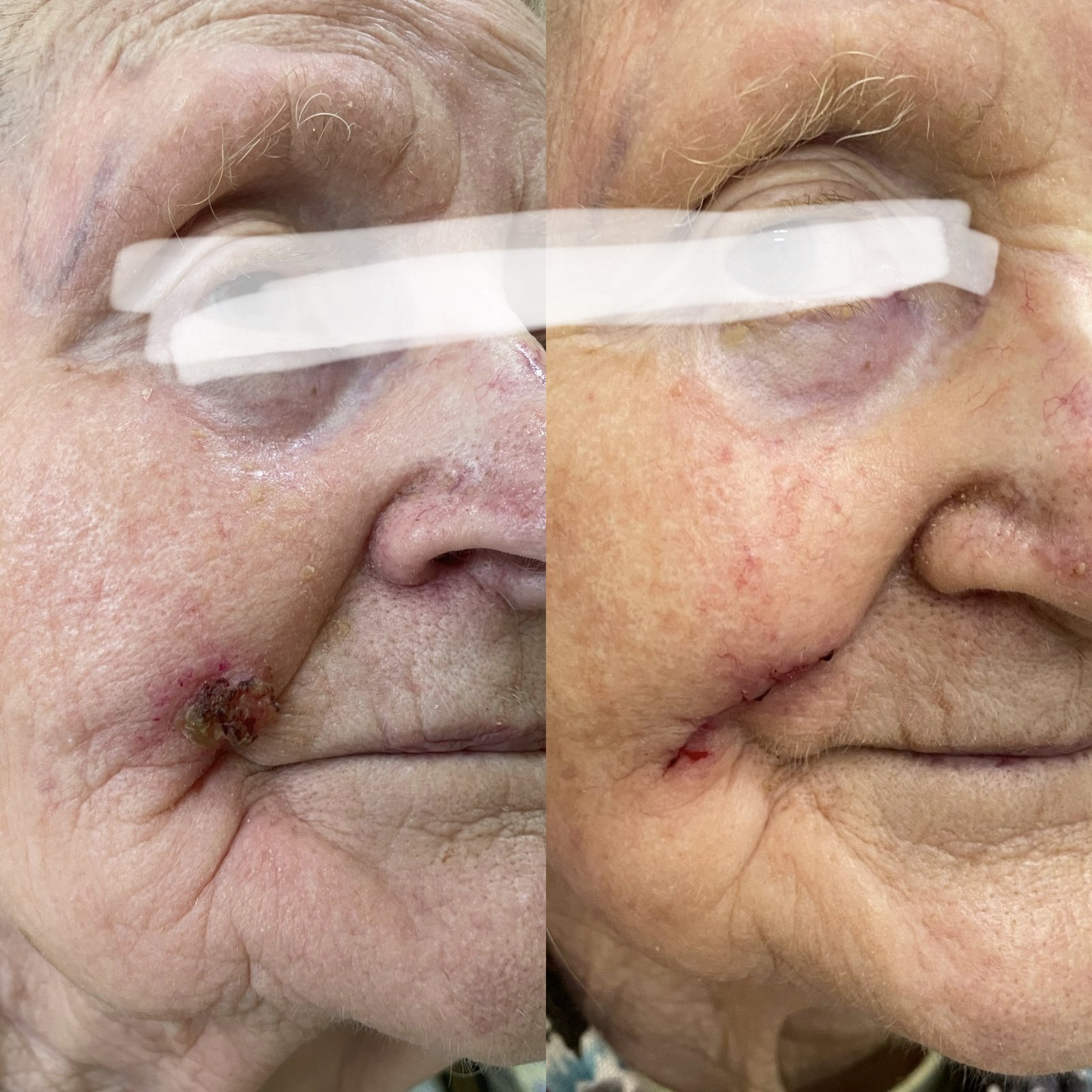 Pacientės nuotrauka „prieš ir po" – patient_new_03.jpg