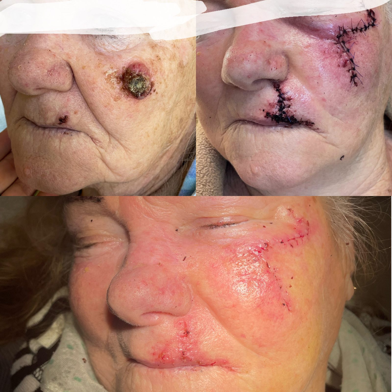 Pacientės nuotrauka „prieš ir po" – patient_045.jpg