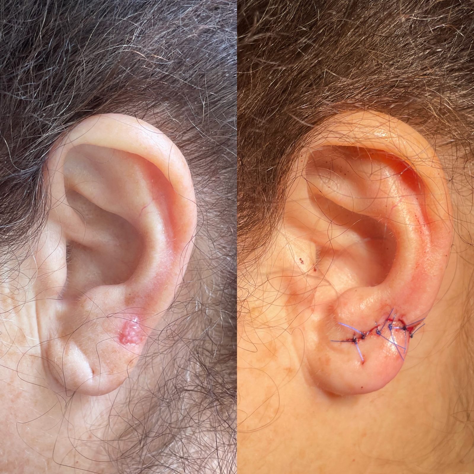 Pacientės nuotrauka „prieš ir po" – patient_011.jpg