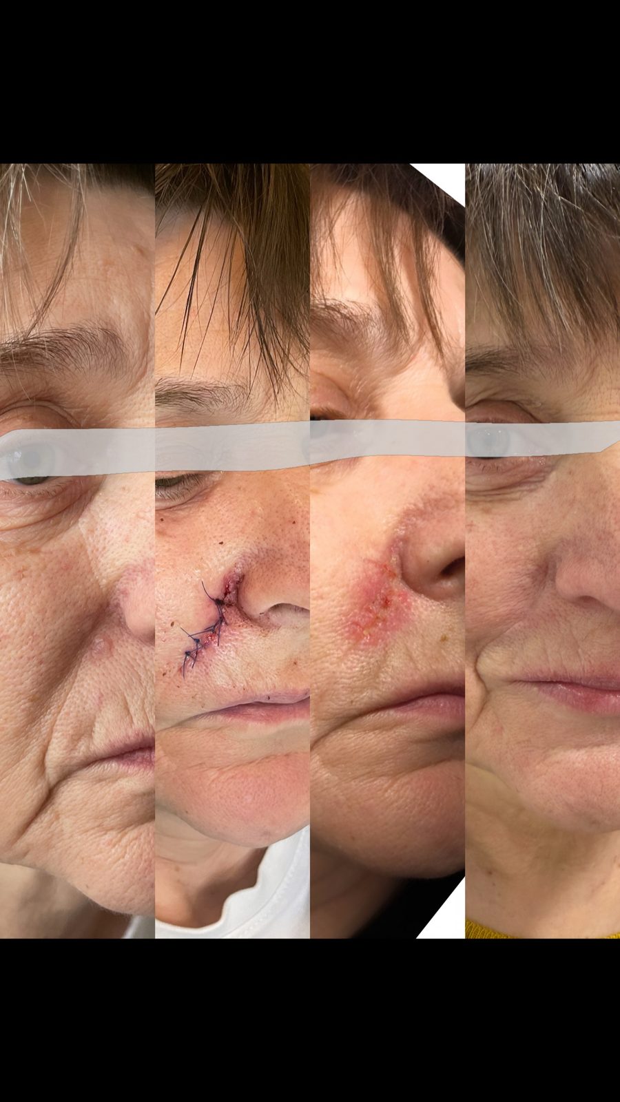 Pacientės nuotrauka „prieš ir po" – patient_005.jpg