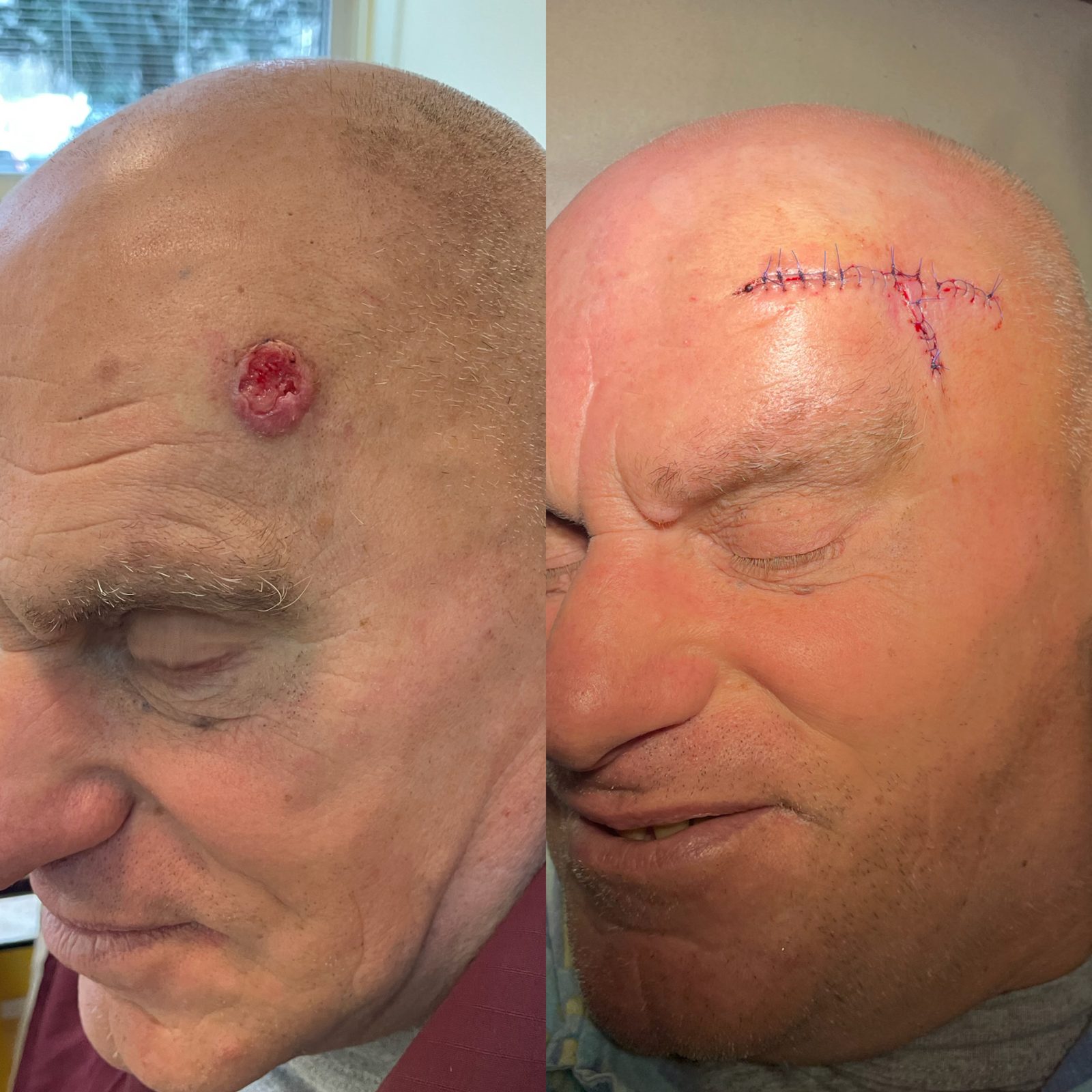 Pacientės nuotrauka „prieš ir po" – patient_074.jpg