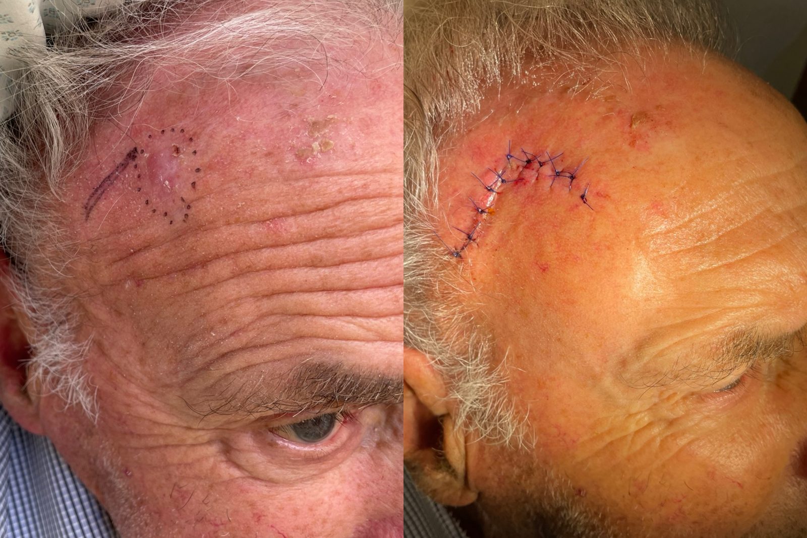 Pacientės nuotrauka „prieš ir po" – patient_040.jpg
