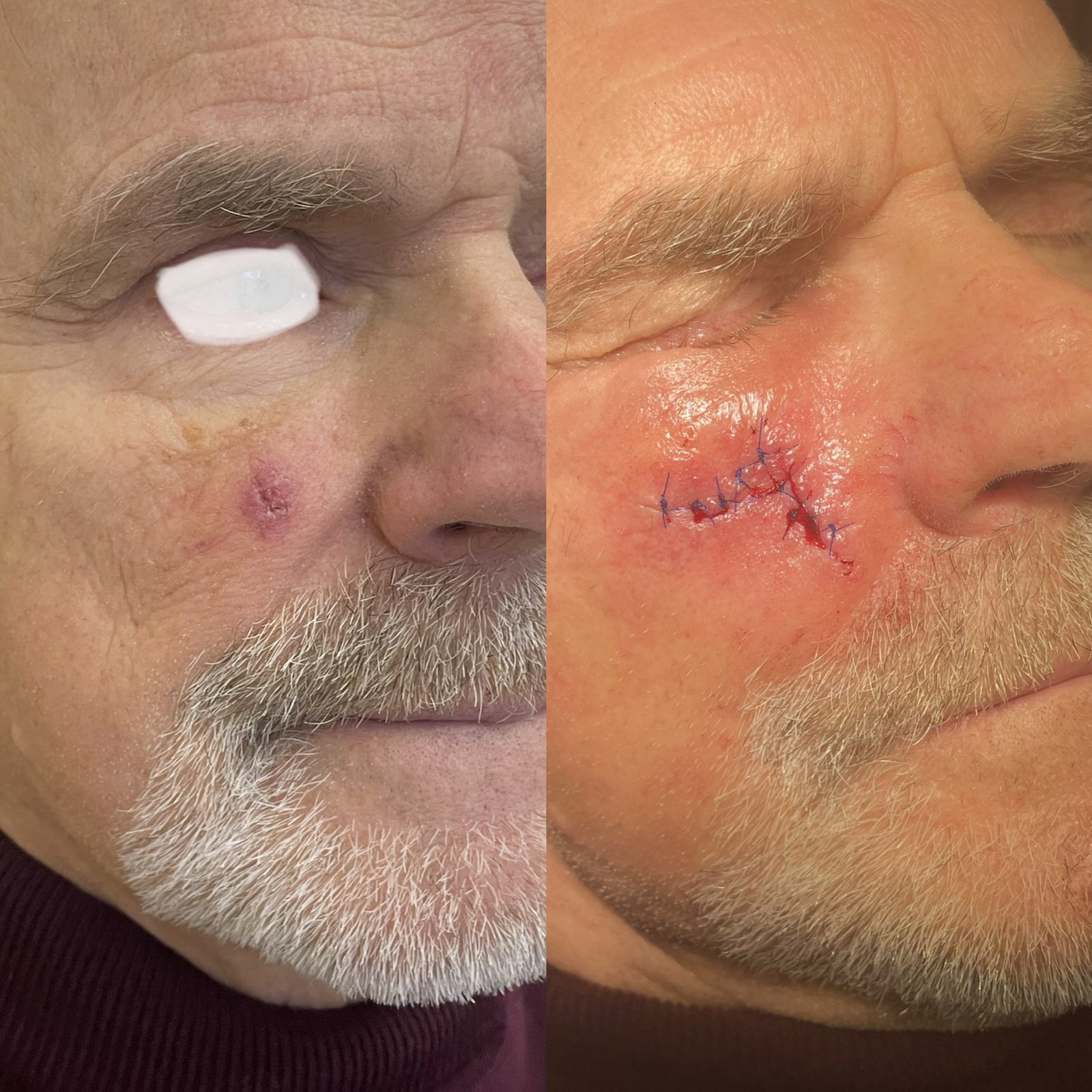 Pacientės nuotrauka „prieš ir po" – patient_069.jpg
