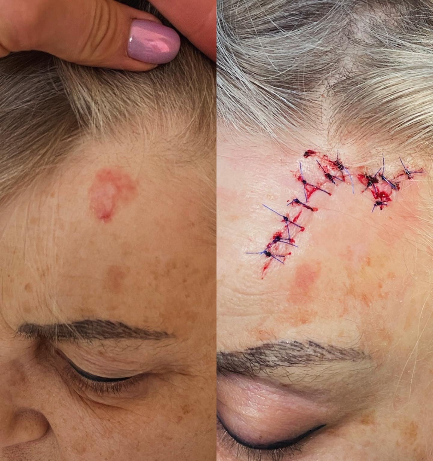 Pacientės nuotrauka „prieš ir po" – patient_002.jpg