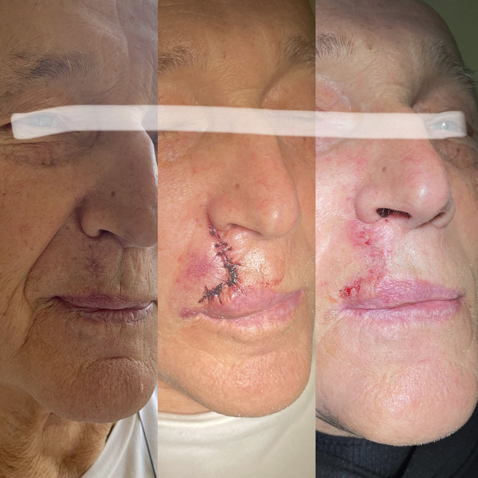Pacientės nuotrauka „prieš ir po" – patient_new_02.jpg