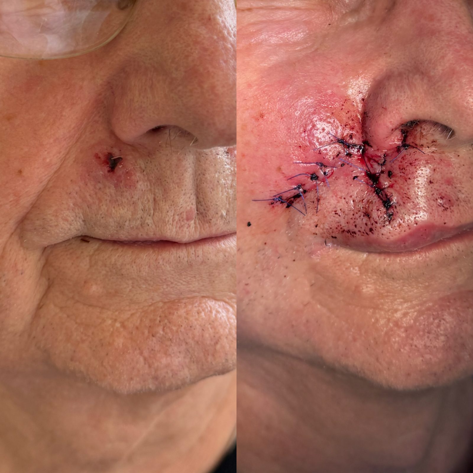 Pacientės nuotrauka „prieš ir po" – patient_043.jpg