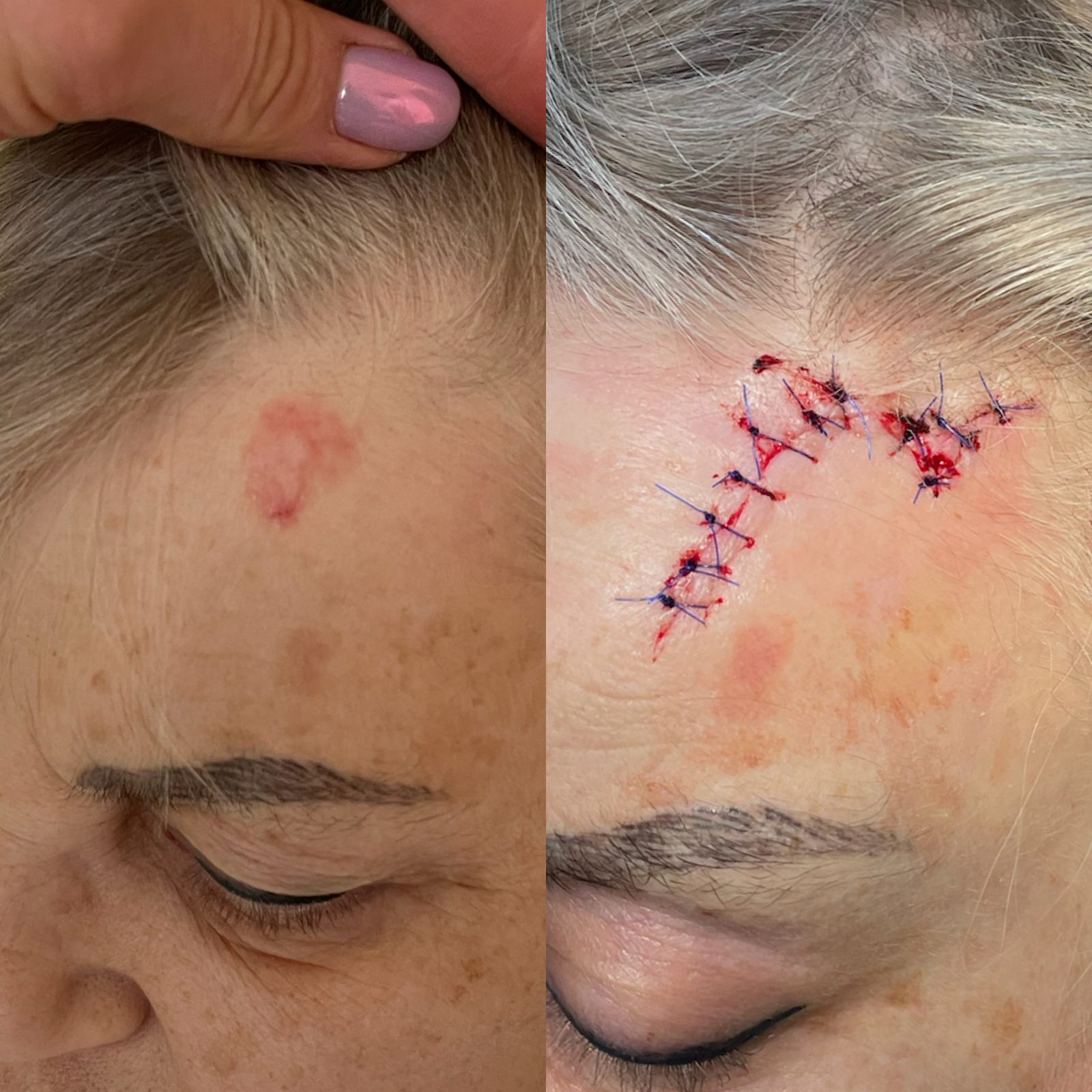 Pacientės nuotrauka „prieš ir po" – patient_024.jpg