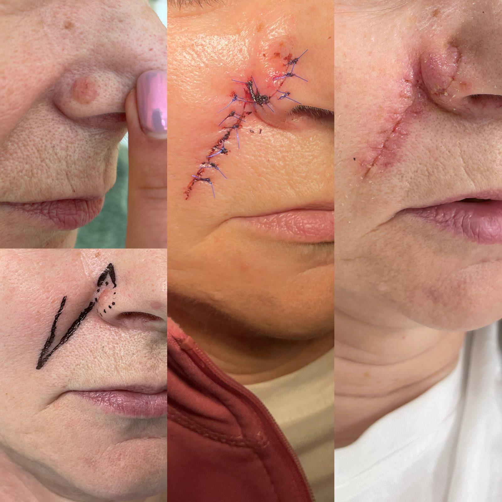 Pacientės nuotrauka „prieš ir po" – patient_028.jpg