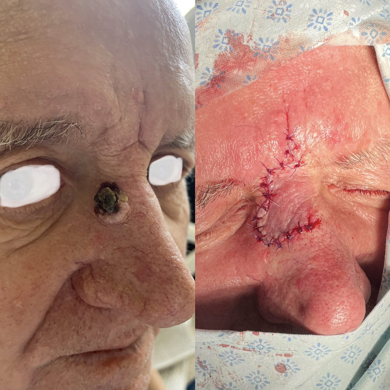 Pacientės nuotrauka „prieš ir po" – patient_049.jpg