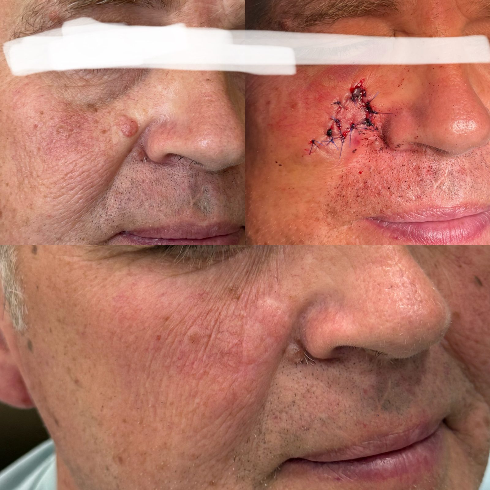 Pacientės nuotrauka „prieš ir po" – patient_034.jpg
