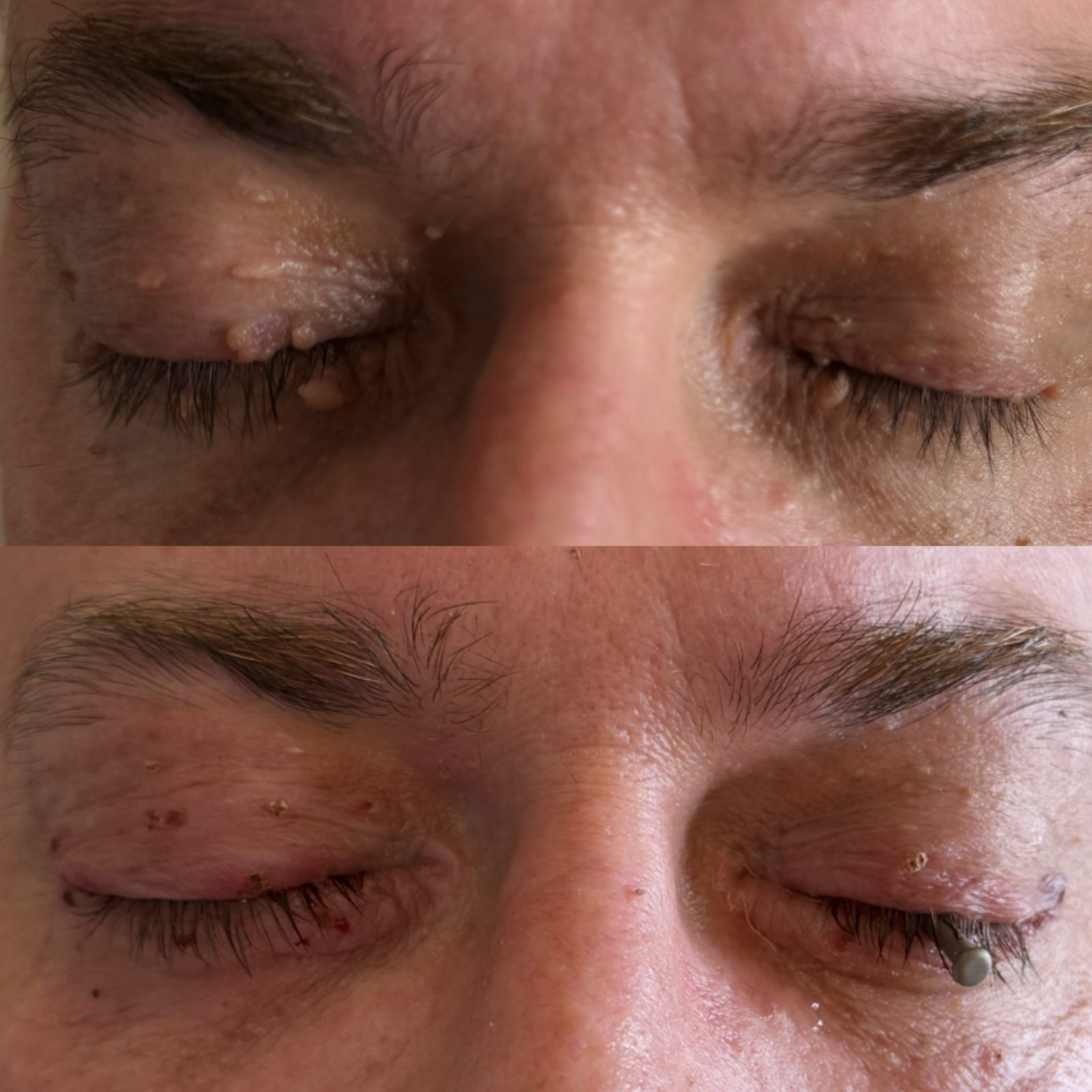 Pacientės nuotrauka „prieš ir po" – patient_061.jpg