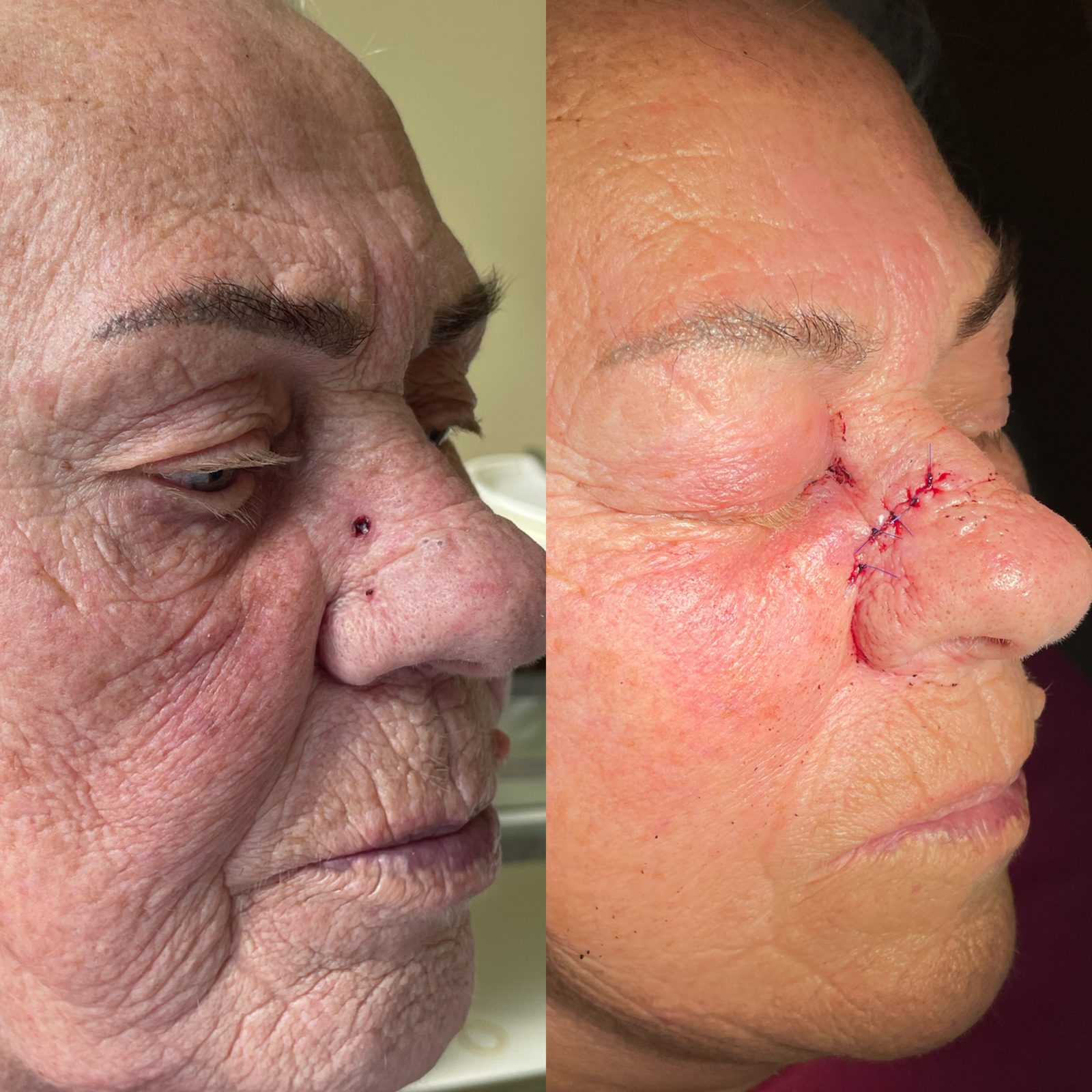 Pacientės nuotrauka „prieš ir po" – patient_007.jpg