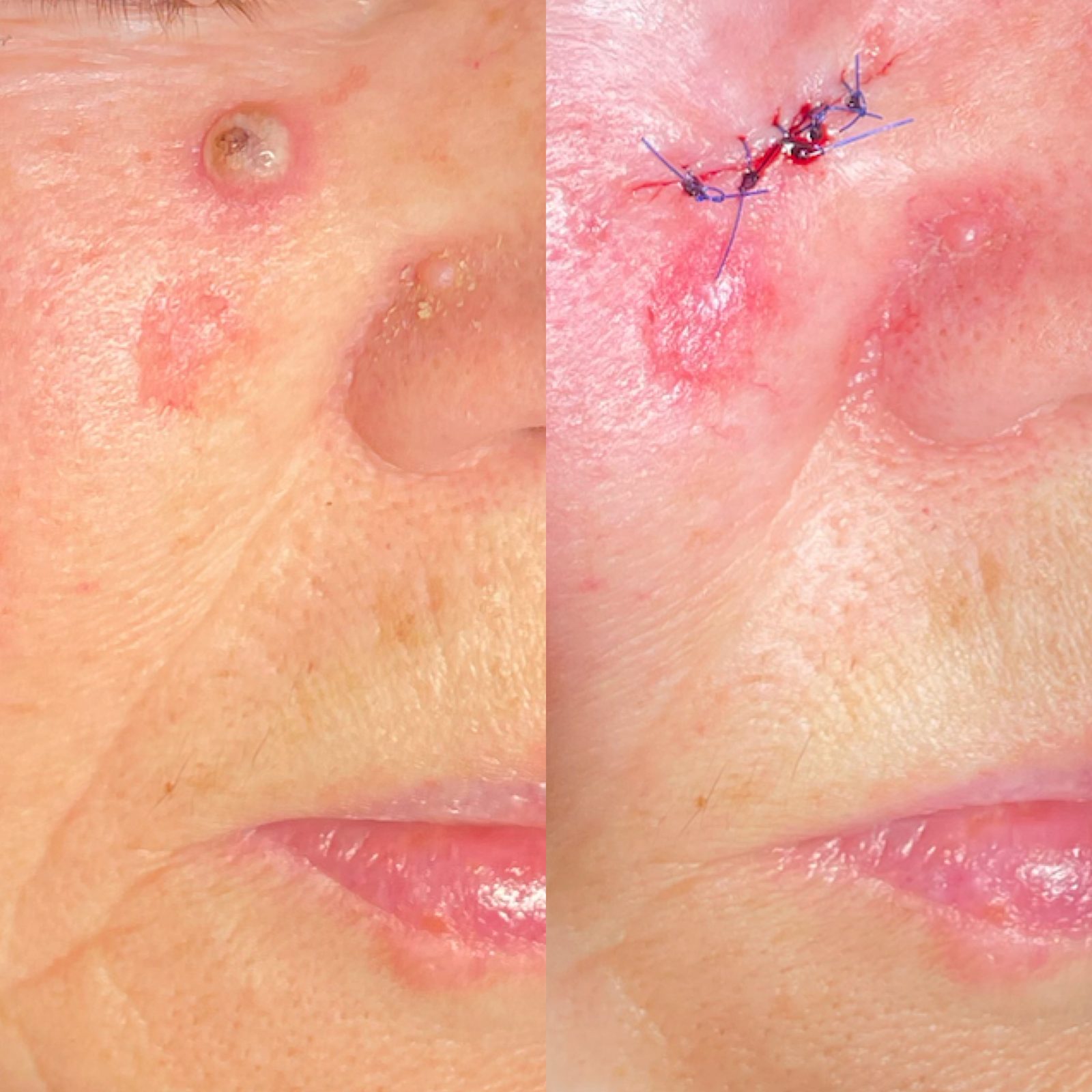 Pacientės nuotrauka „prieš ir po" – patient_027.jpg