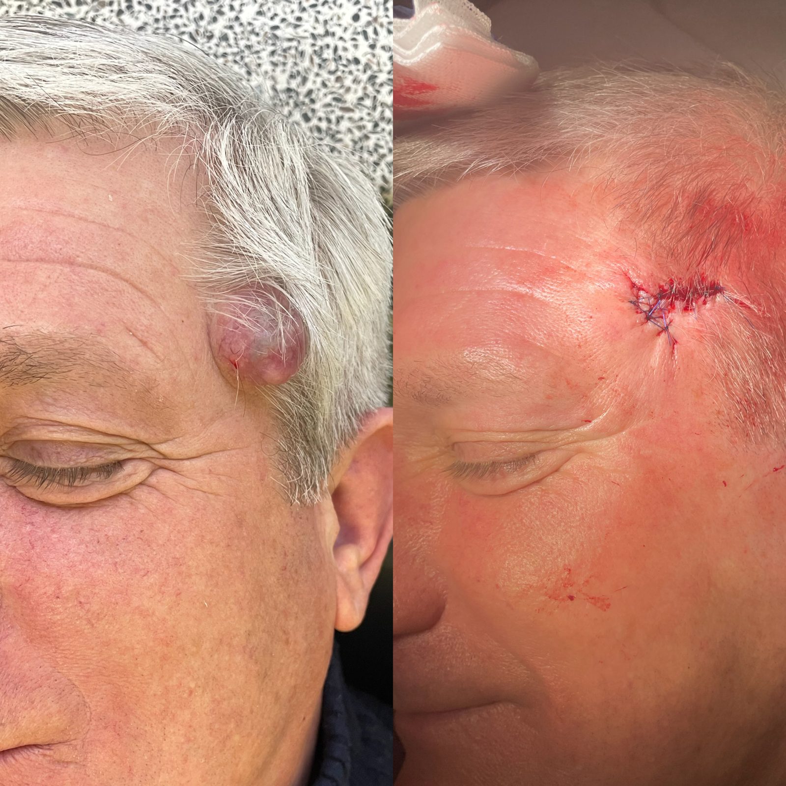 Pacientės nuotrauka „prieš ir po" – patient_068.jpg