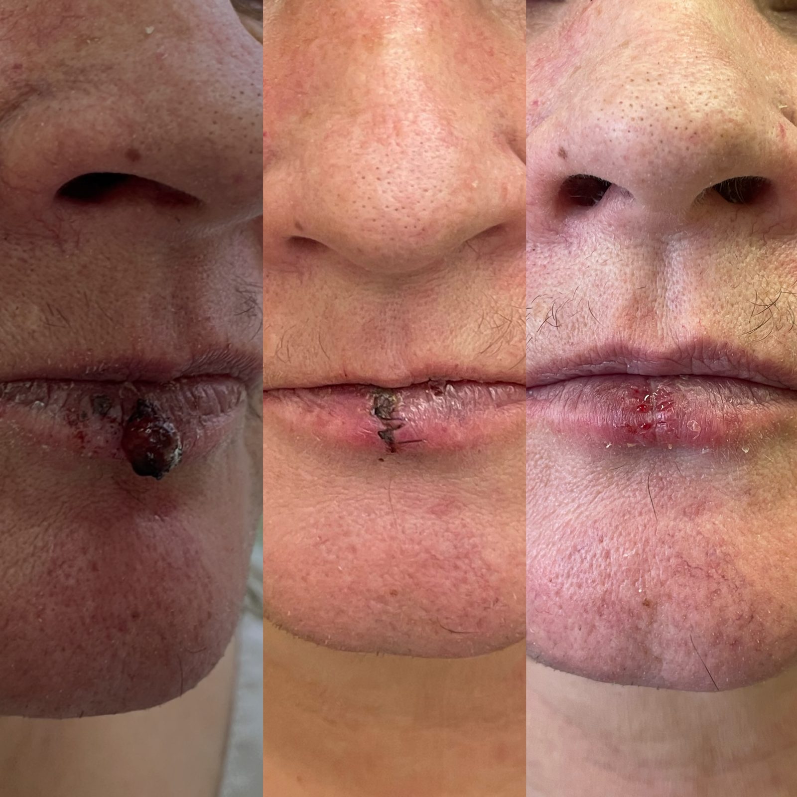 Pacientės nuotrauka „prieš ir po" – patient_056.jpg
