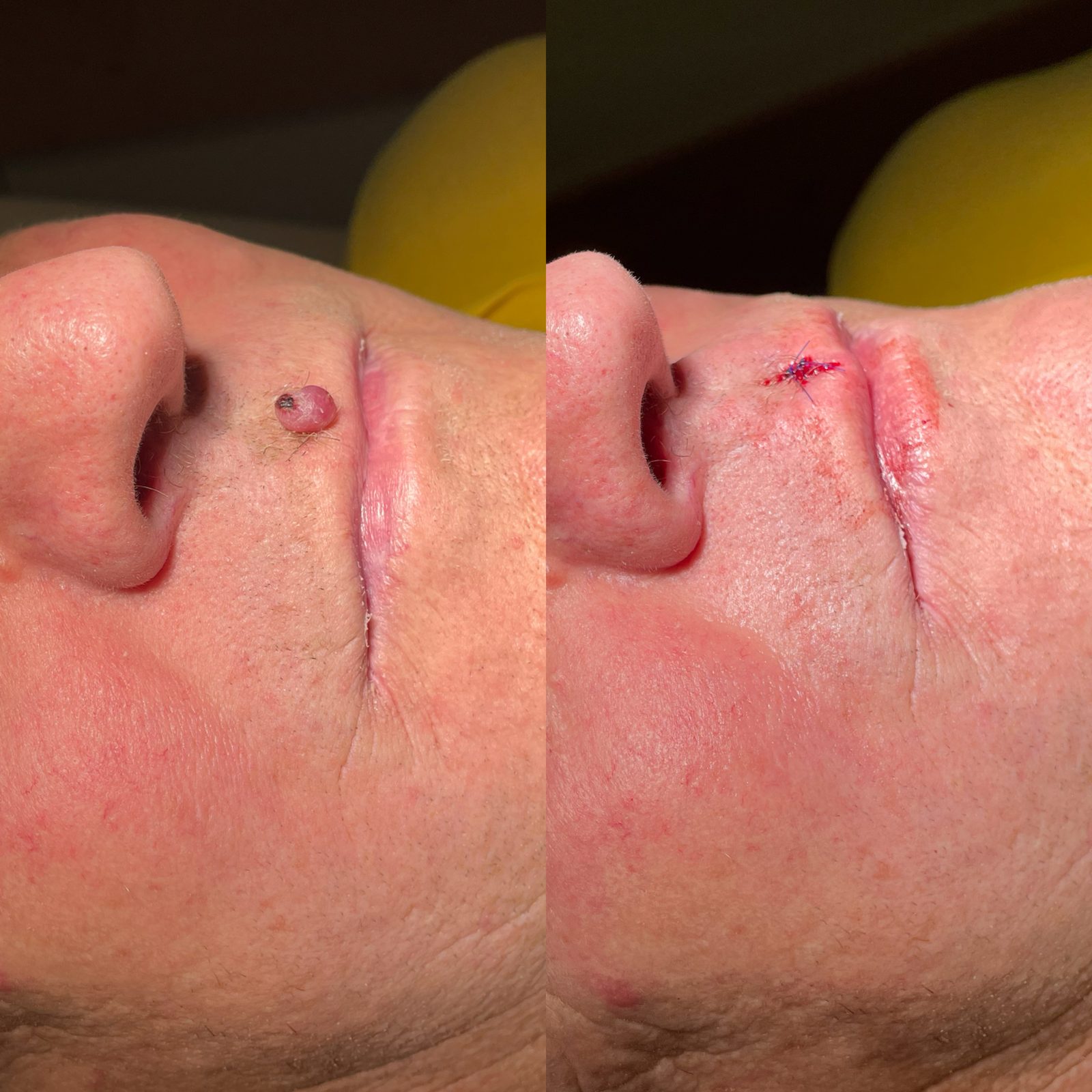 Pacientės nuotrauka „prieš ir po" – patient_076.jpg