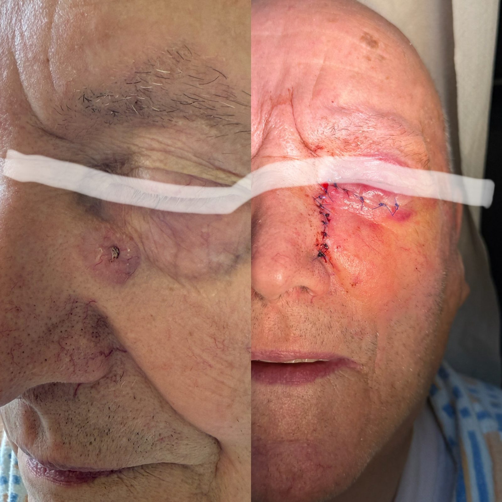 Pacientės nuotrauka „prieš ir po" – patient_038.jpg