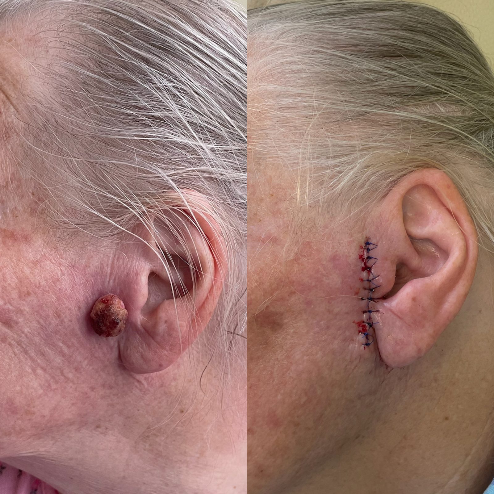 Pacientės nuotrauka „prieš ir po" – patient_010.jpg