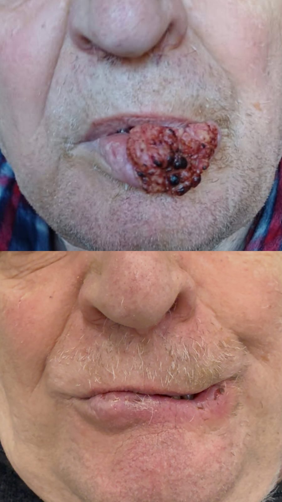 Pacientės nuotrauka „prieš ir po" – patient_075.jpg