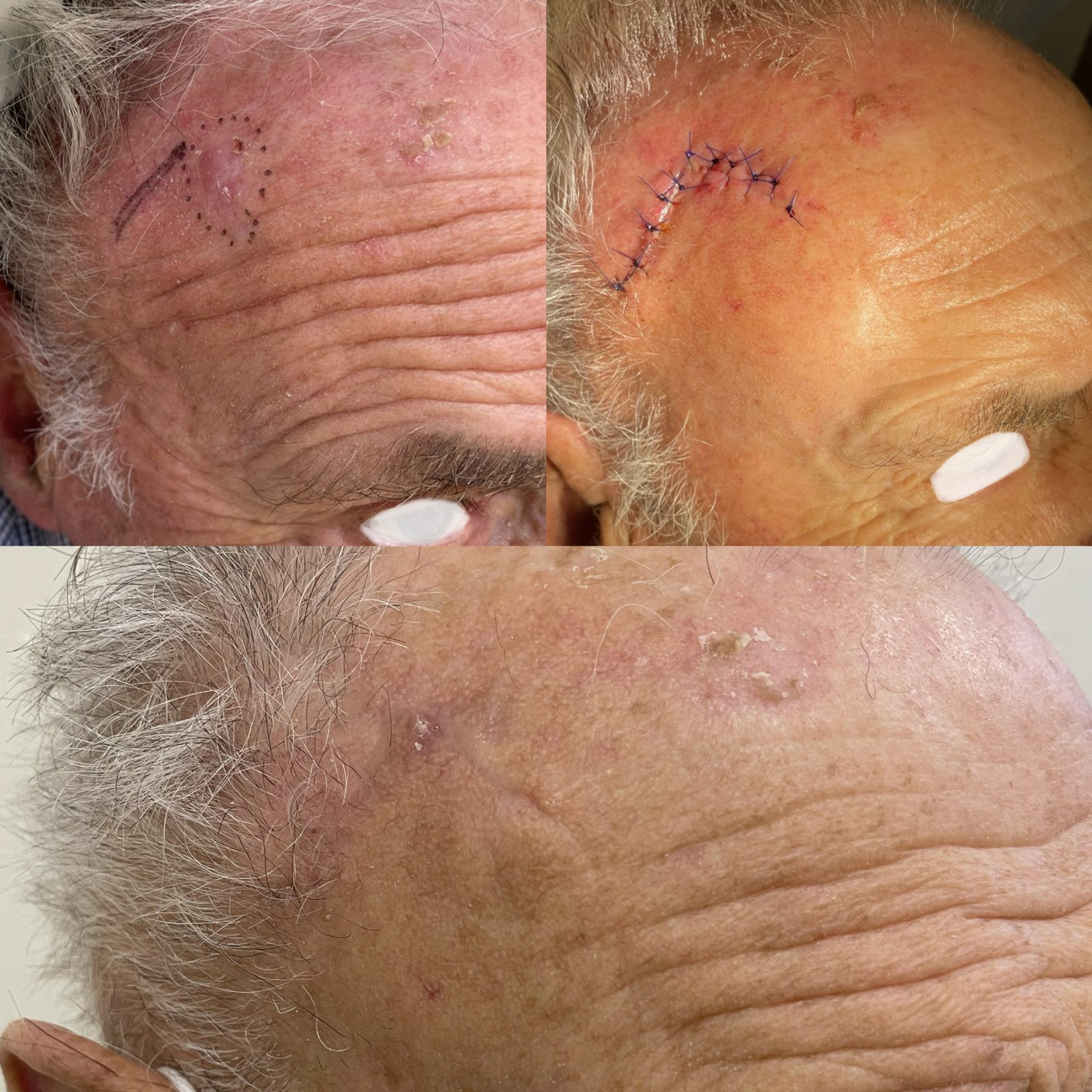 Pacientės nuotrauka „prieš ir po" – patient_047.jpg
