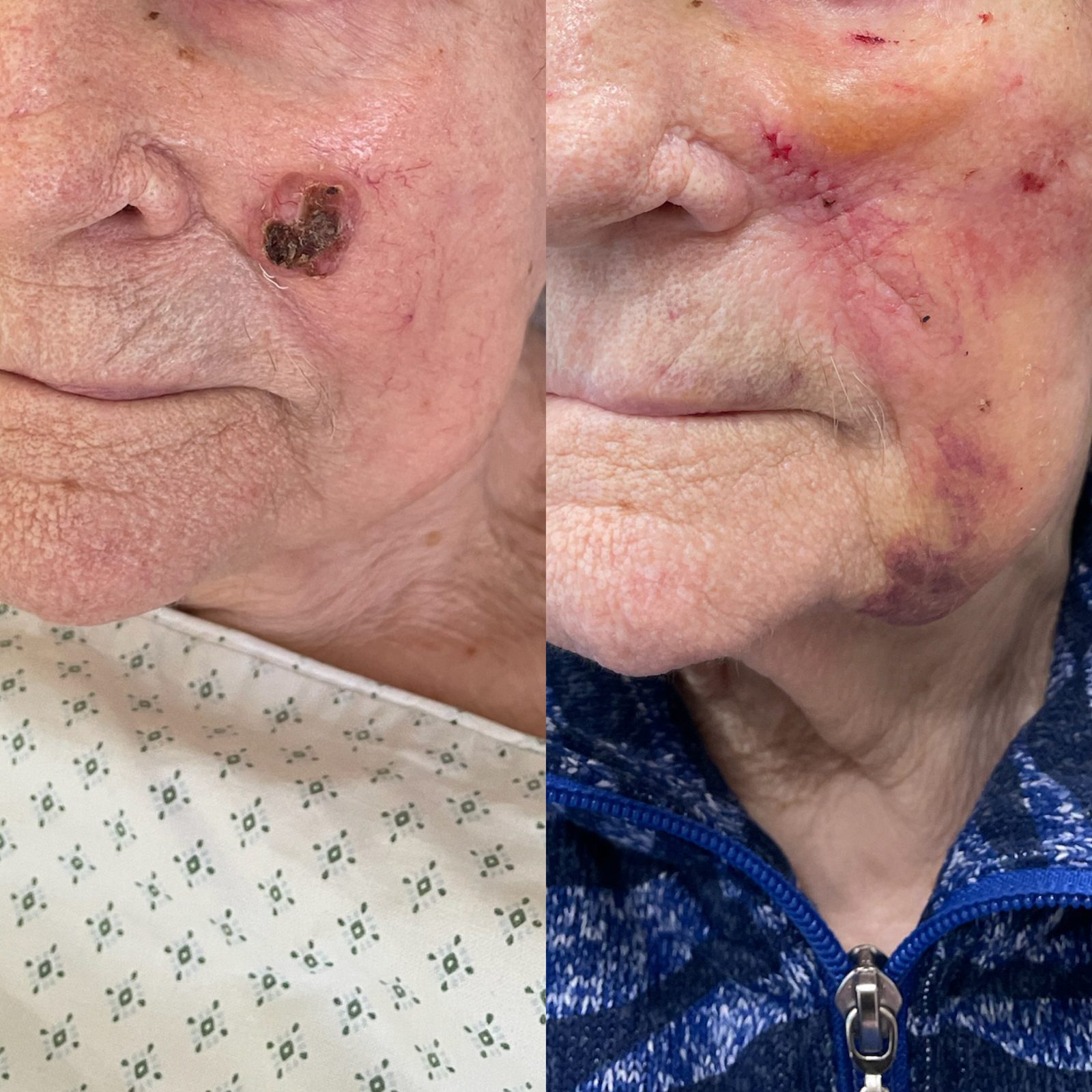 Pacientės nuotrauka „prieš ir po" – patient_022.jpg