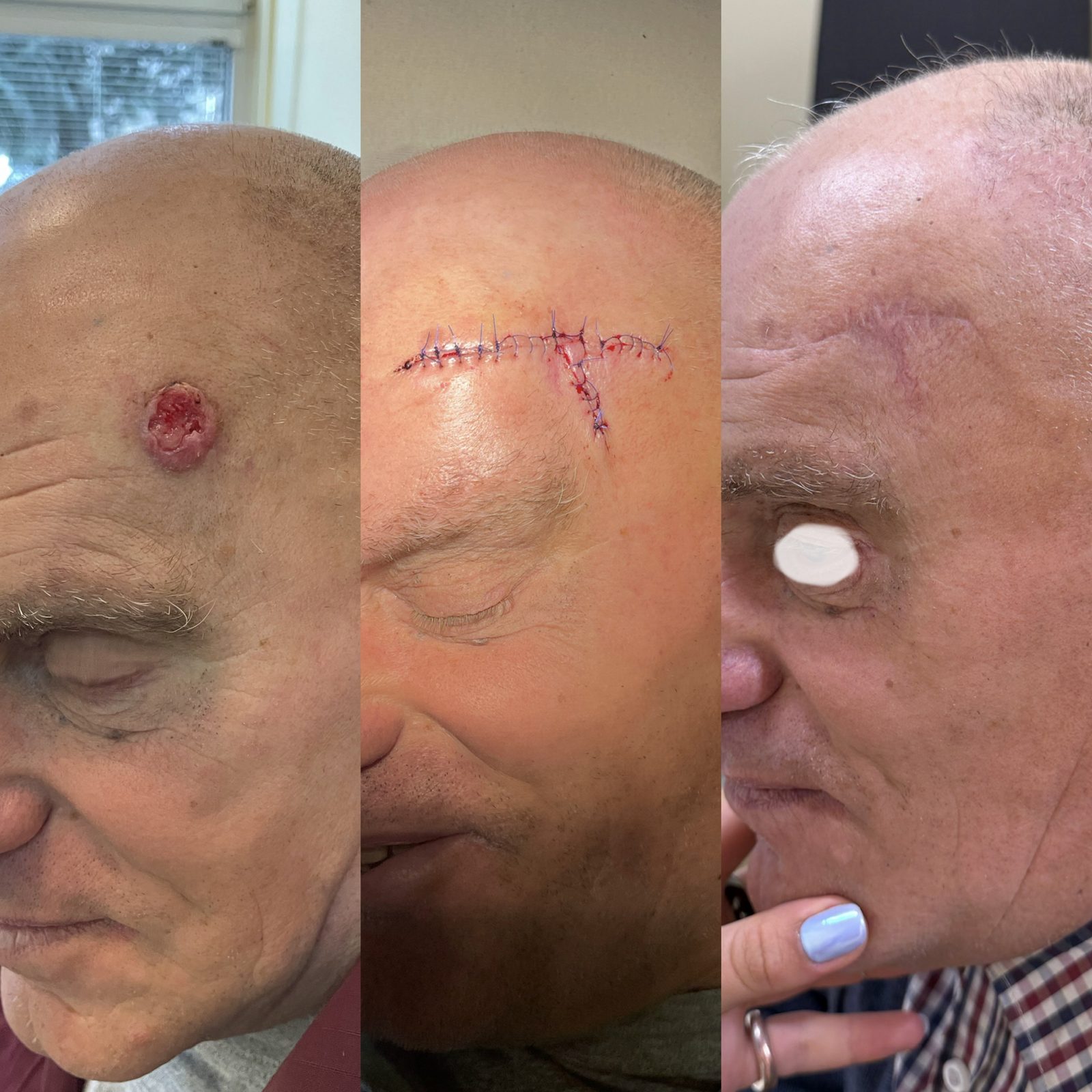 Pacientės nuotrauka „prieš ir po" – patient_036.jpg