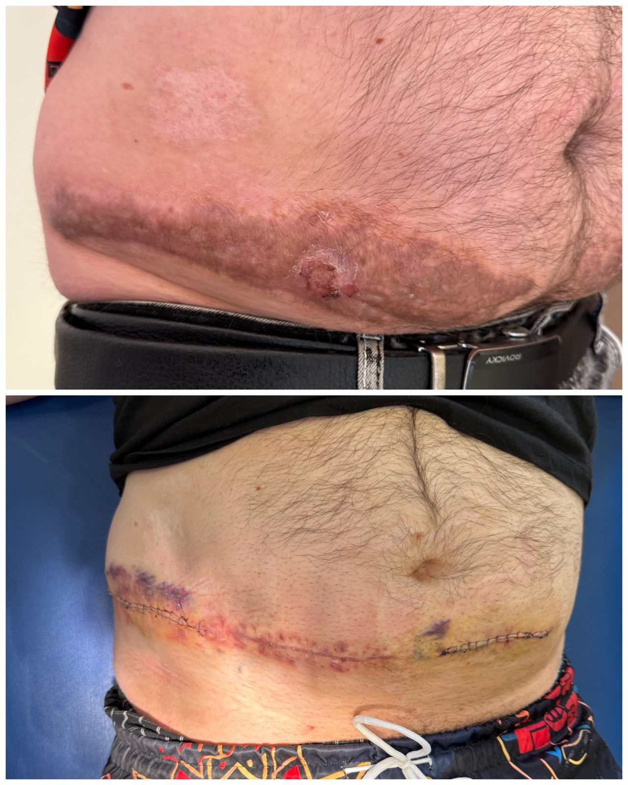 Pacientės nuotrauka „prieš ir po" – patient_016.jpg