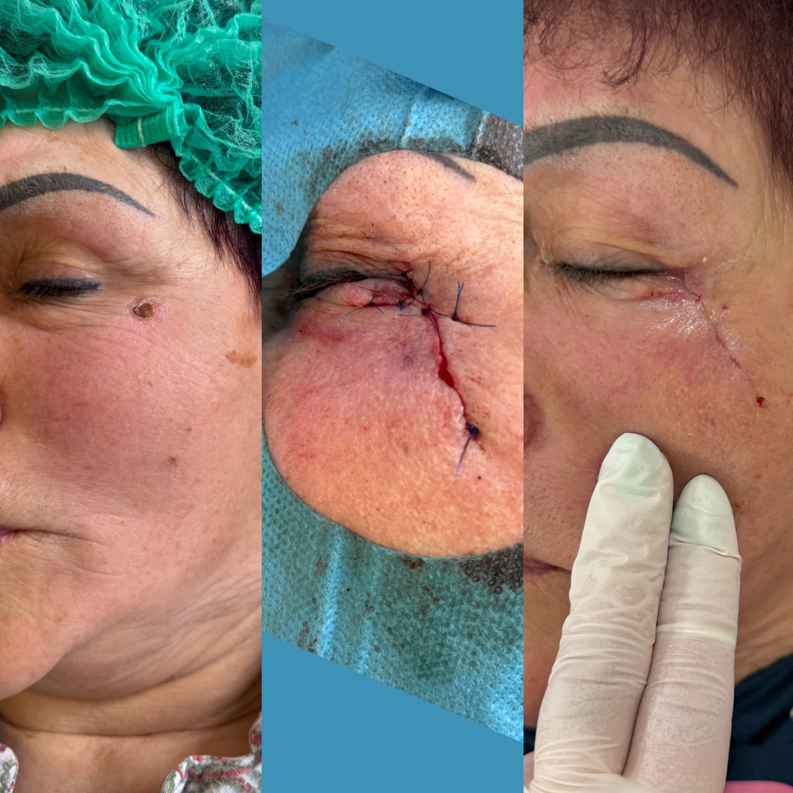 Pacientės nuotrauka „prieš ir po" – patient_032.jpg