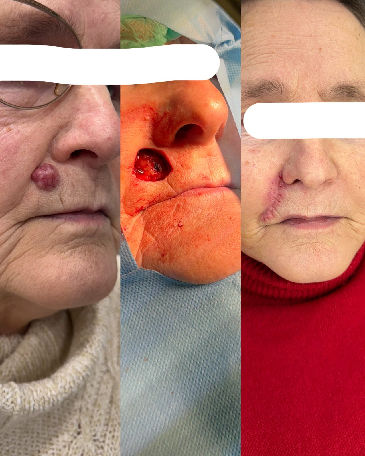 Pacientės nuotrauka „prieš ir po" – patient_013.jpg