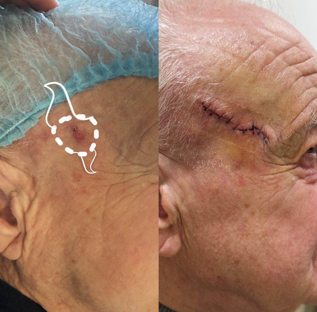 Pacientės nuotrauka „prieš ir po" – patient_004.jpg