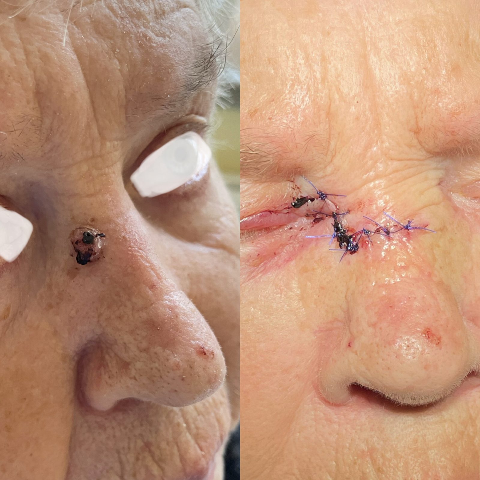 Pacientės nuotrauka „prieš ir po" – patient_052.jpg
