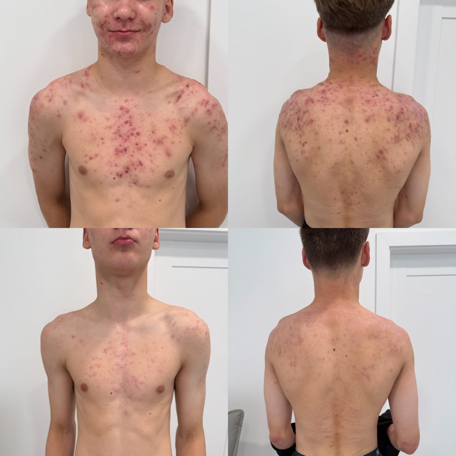 Pacientės nuotrauka „prieš ir po" – patient_033.jpg