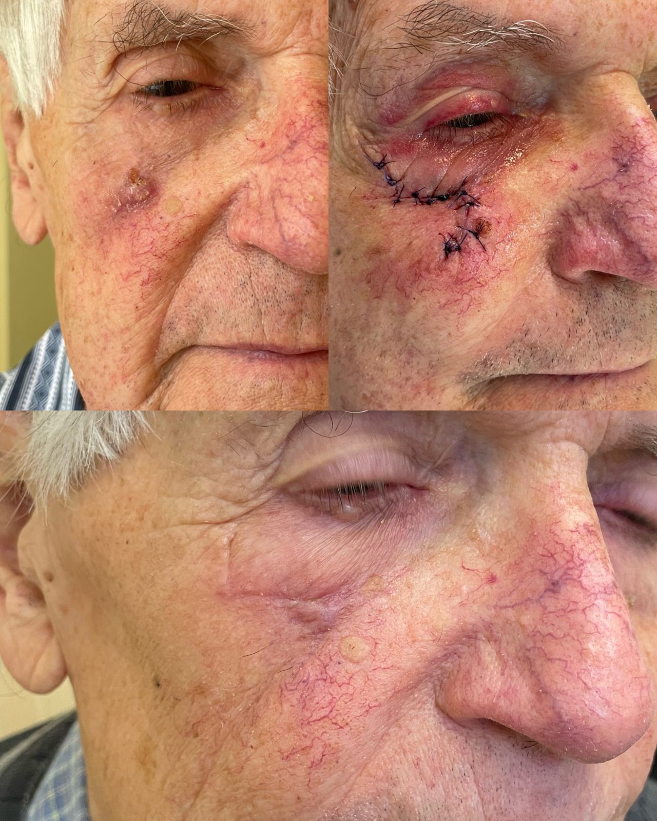 Pacientės nuotrauka „prieš ir po" – patient_042.jpg