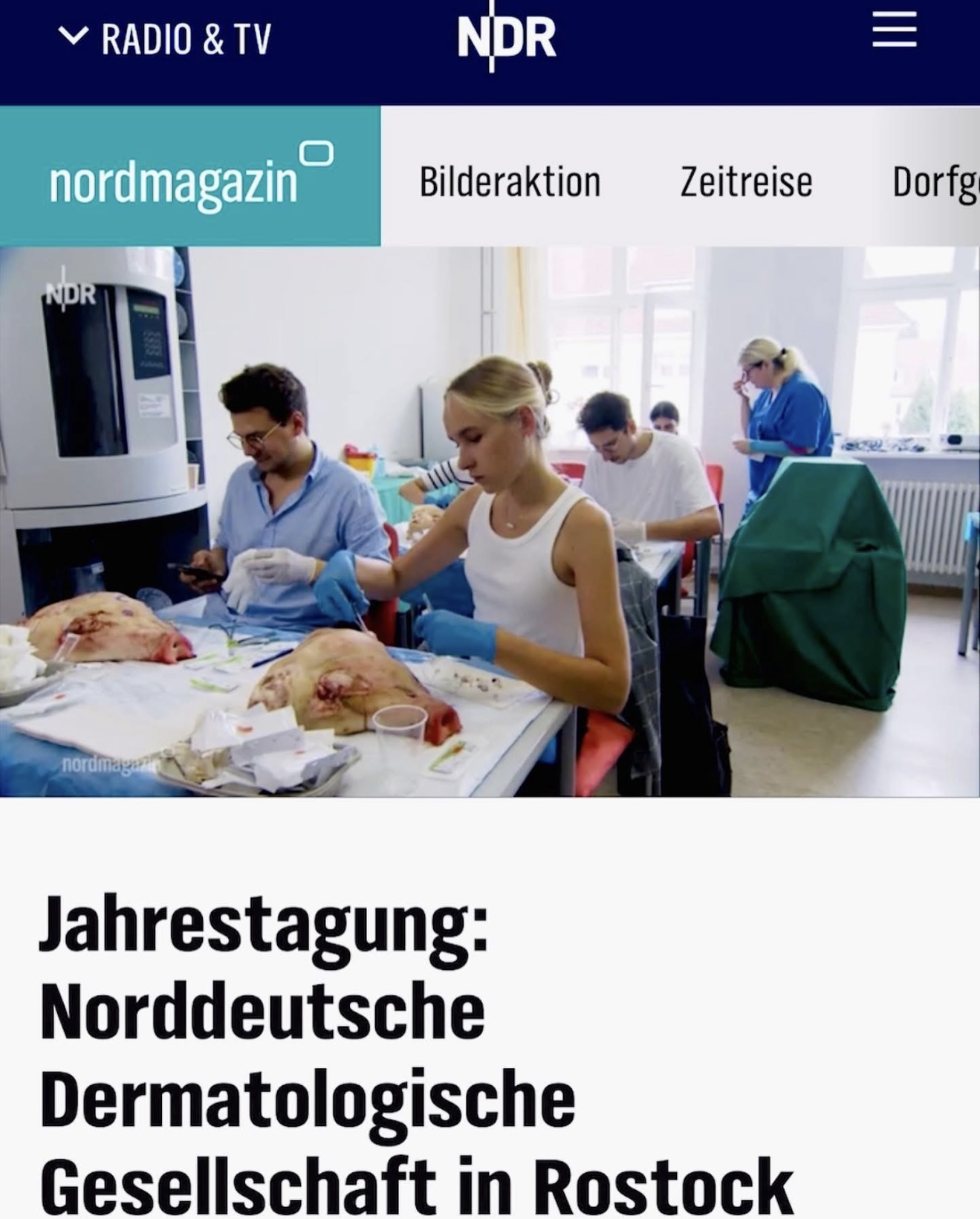 Pacientės nuotrauka „prieš ir po" – patient_zzz_03.jpeg
