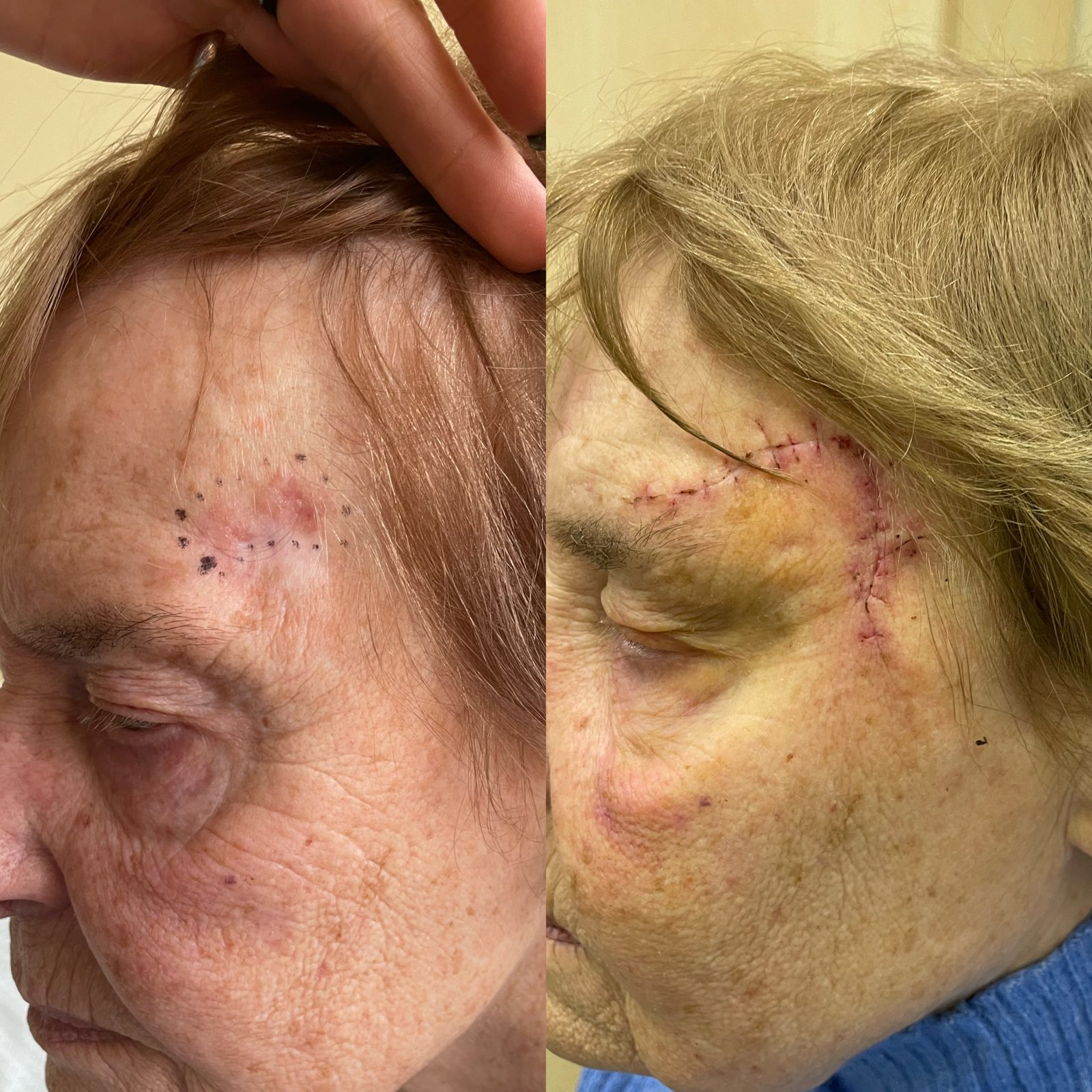 Pacientės nuotrauka „prieš ir po" – patient_063.jpg