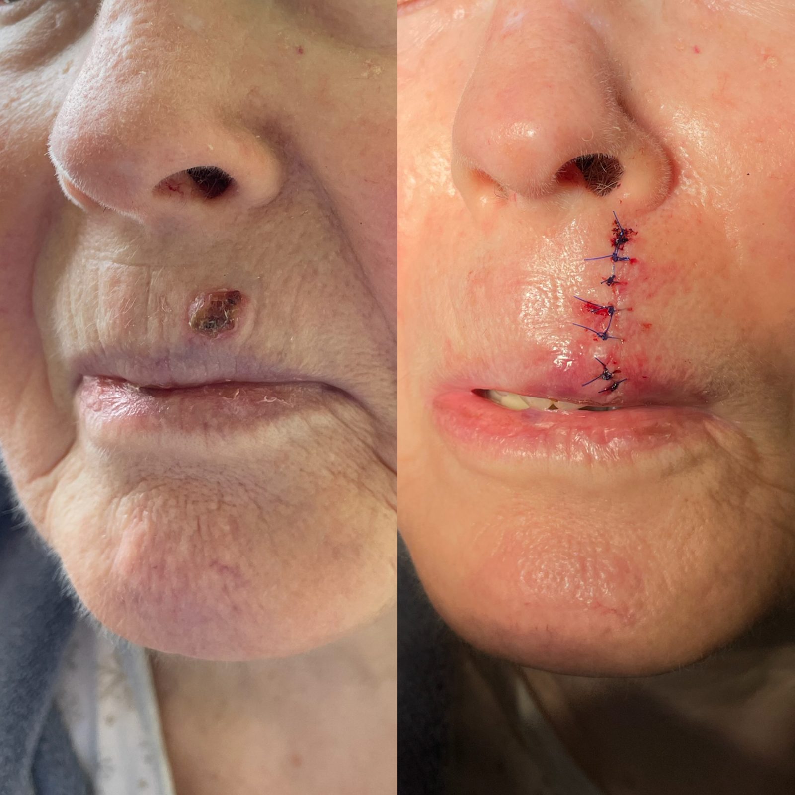 Pacientės nuotrauka „prieš ir po" – patient_023.jpg