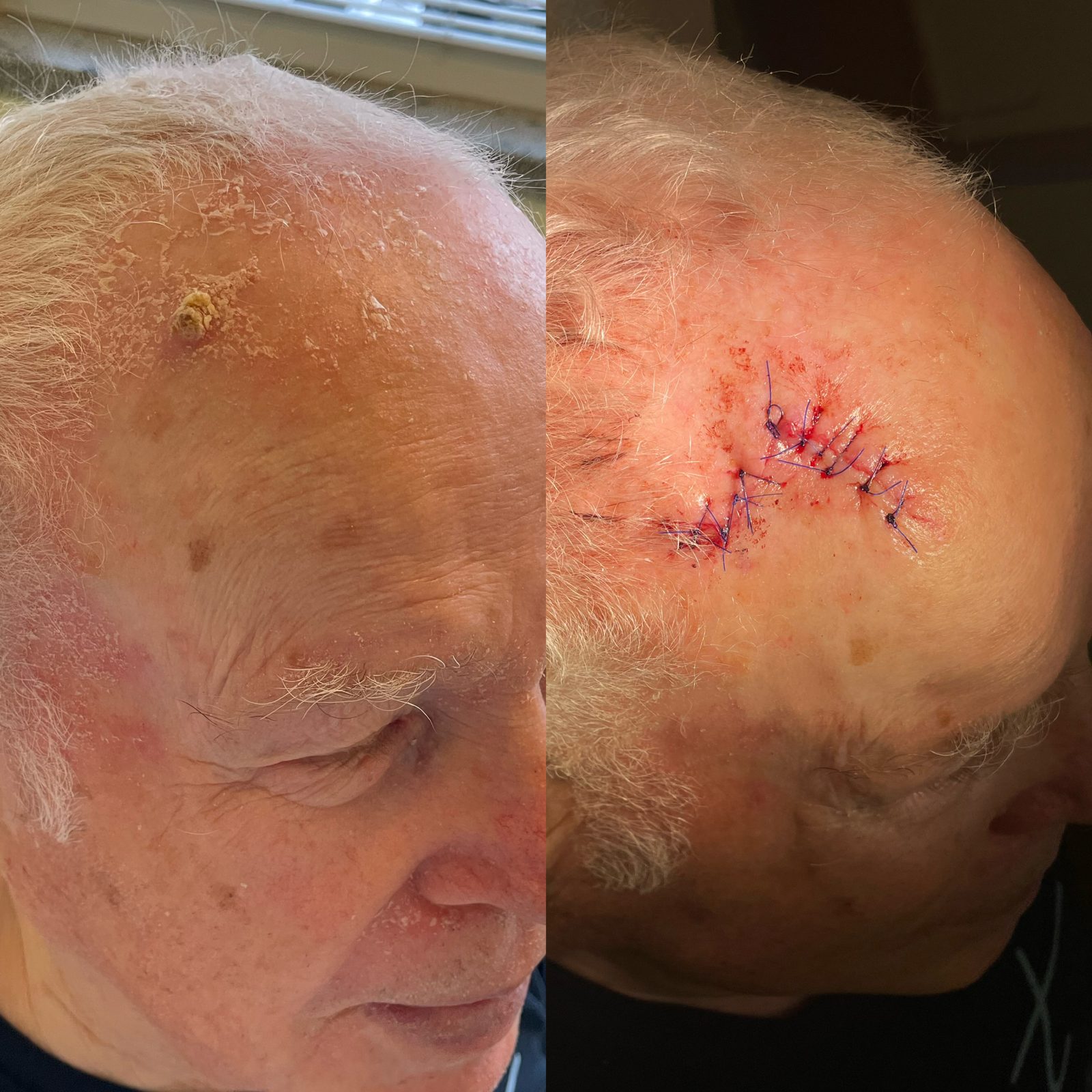 Pacientės nuotrauka „prieš ir po" – patient_054.jpg