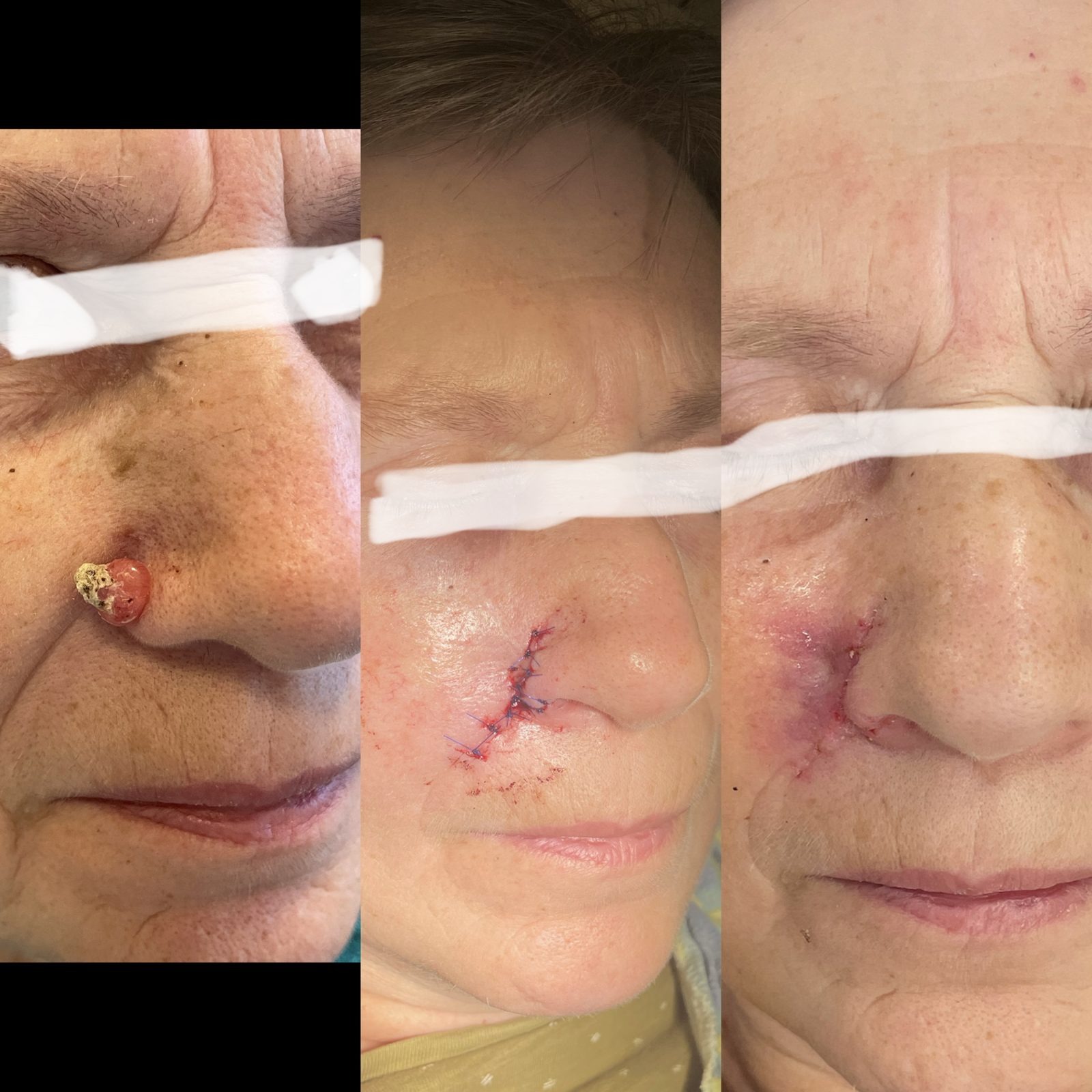 Pacientės nuotrauka „prieš ir po" – patient_071.jpg