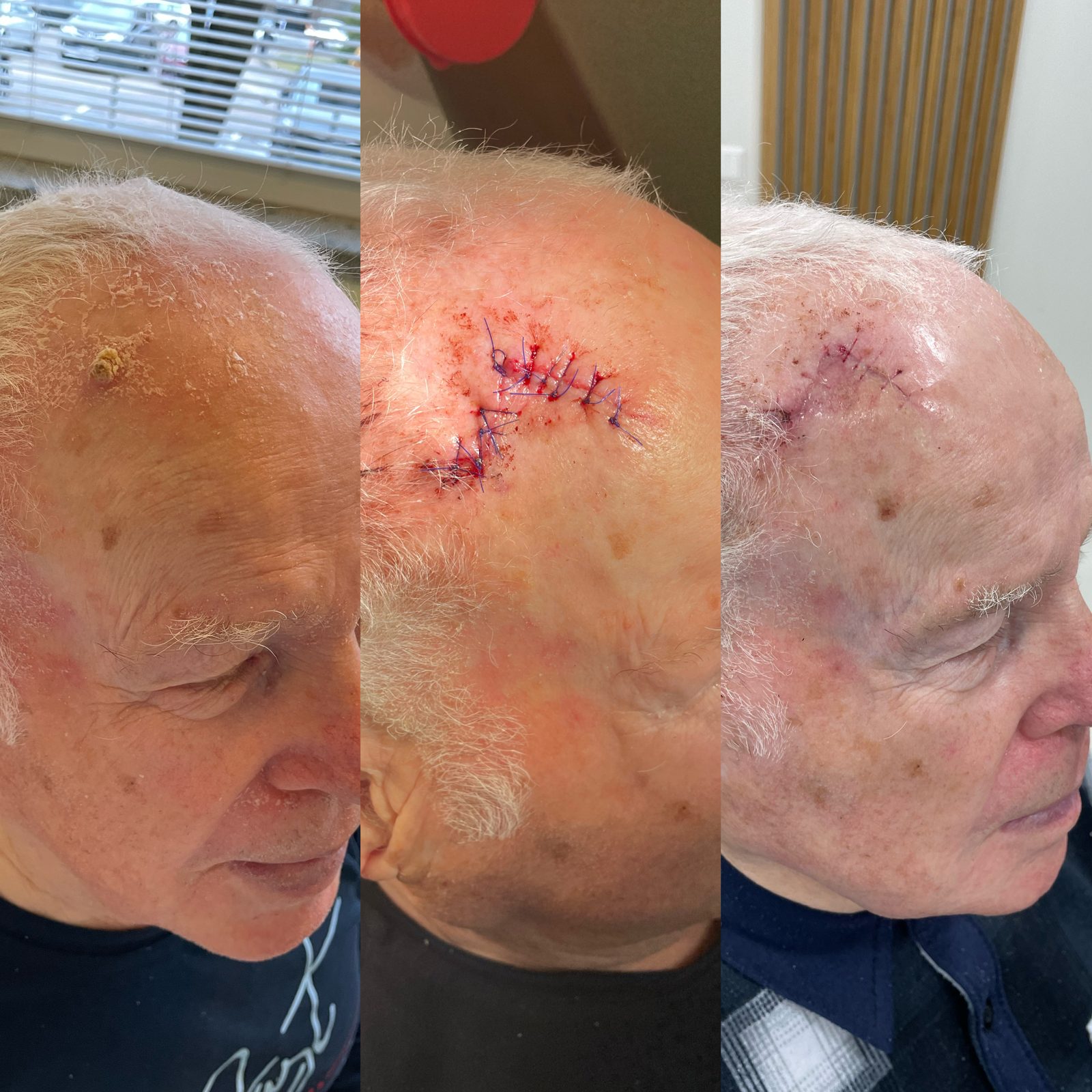 Pacientės nuotrauka „prieš ir po" – patient_058.jpg