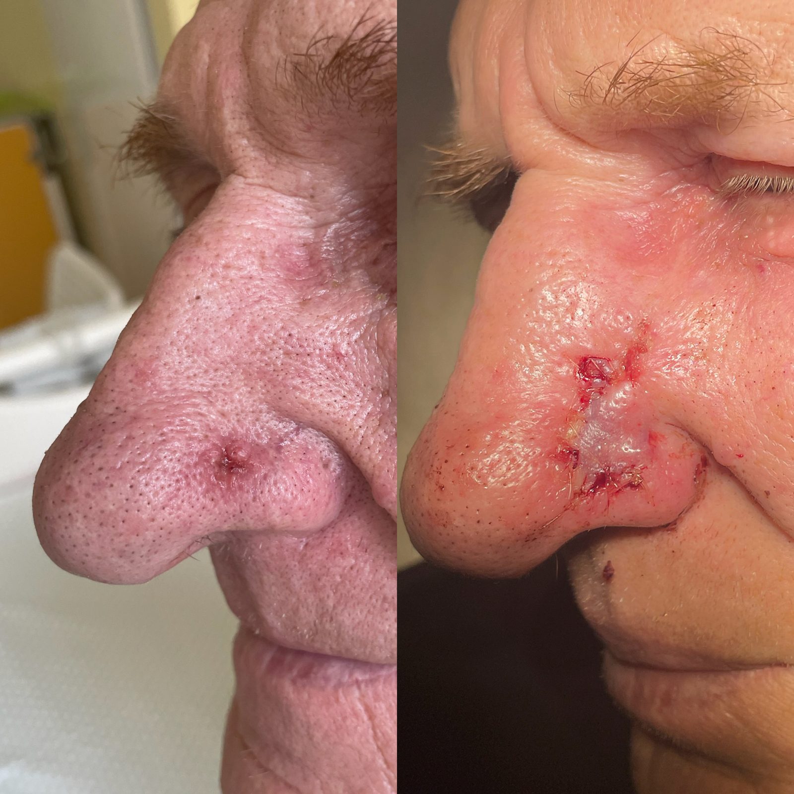 Pacientės nuotrauka „prieš ir po" – patient_008.jpg