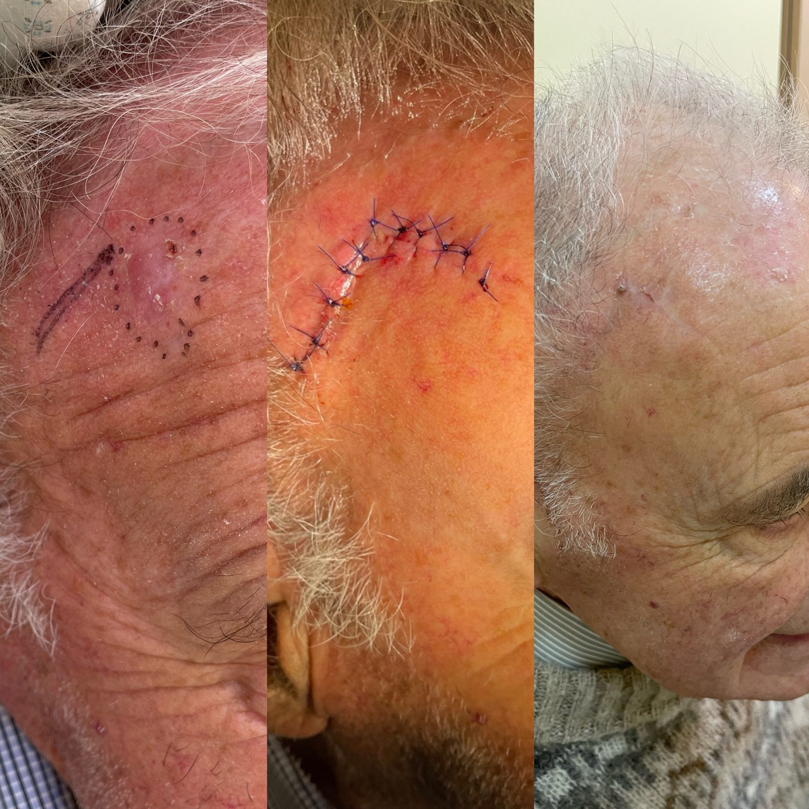 Pacientės nuotrauka „prieš ir po" – patient_059.jpg