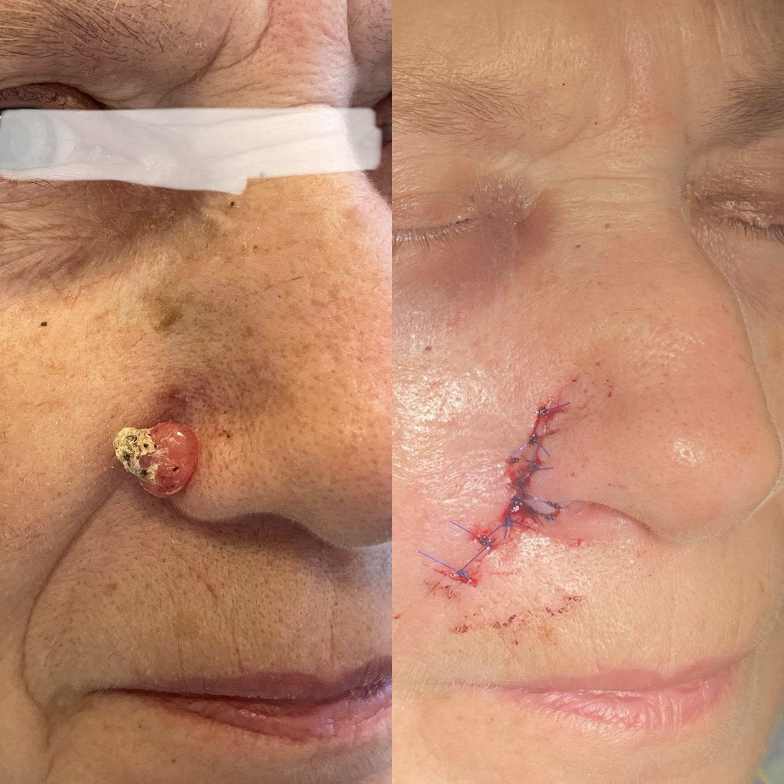 Pacientės nuotrauka „prieš ir po" – patient_new_05.jpg